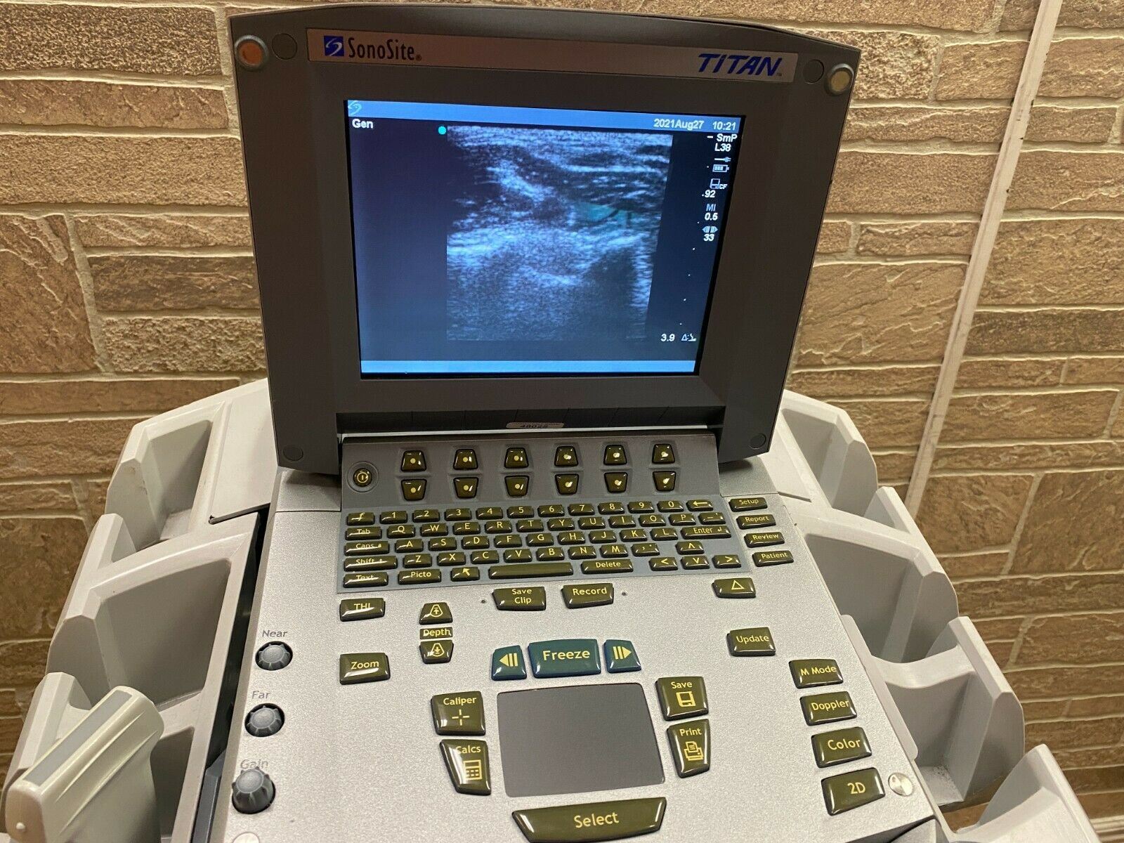 SONOSITE TITAN PORTABLE ULTRASOUND MACHINE WITH 1 PROBE (L38) 08/2004 DIAGNOSTIC ULTRASOUND MACHINES FOR SALE