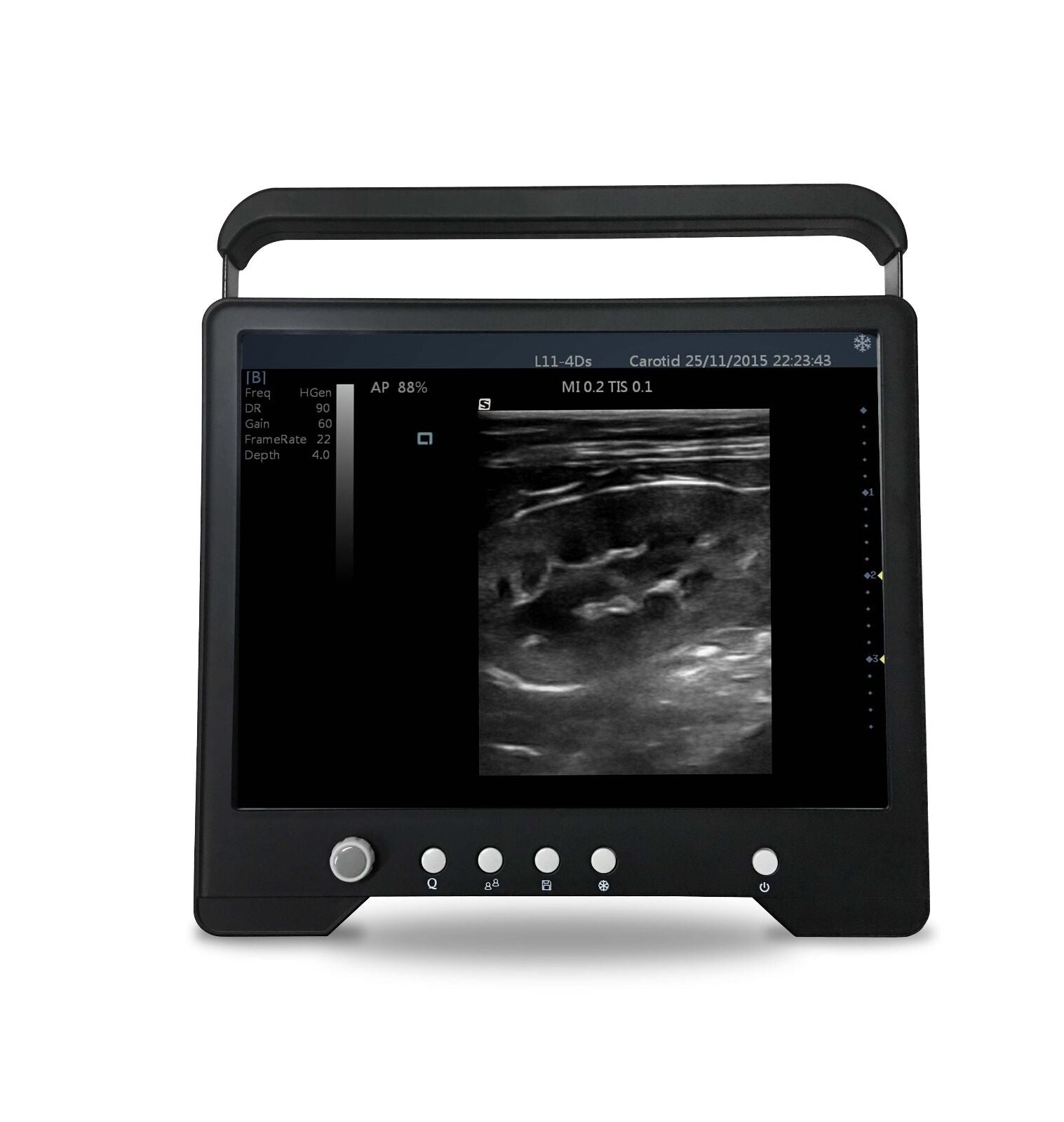 Veterinary Touch Screen Ultrasound with Rectal Probe for Large Animals, KeeboMed DIAGNOSTIC ULTRASOUND MACHINES FOR SALE