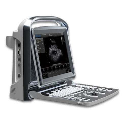 Chison ECO1 Portable Ultrasound with Linear Array Probe MSK and Printer Included DIAGNOSTIC ULTRASOUND MACHINES FOR SALE