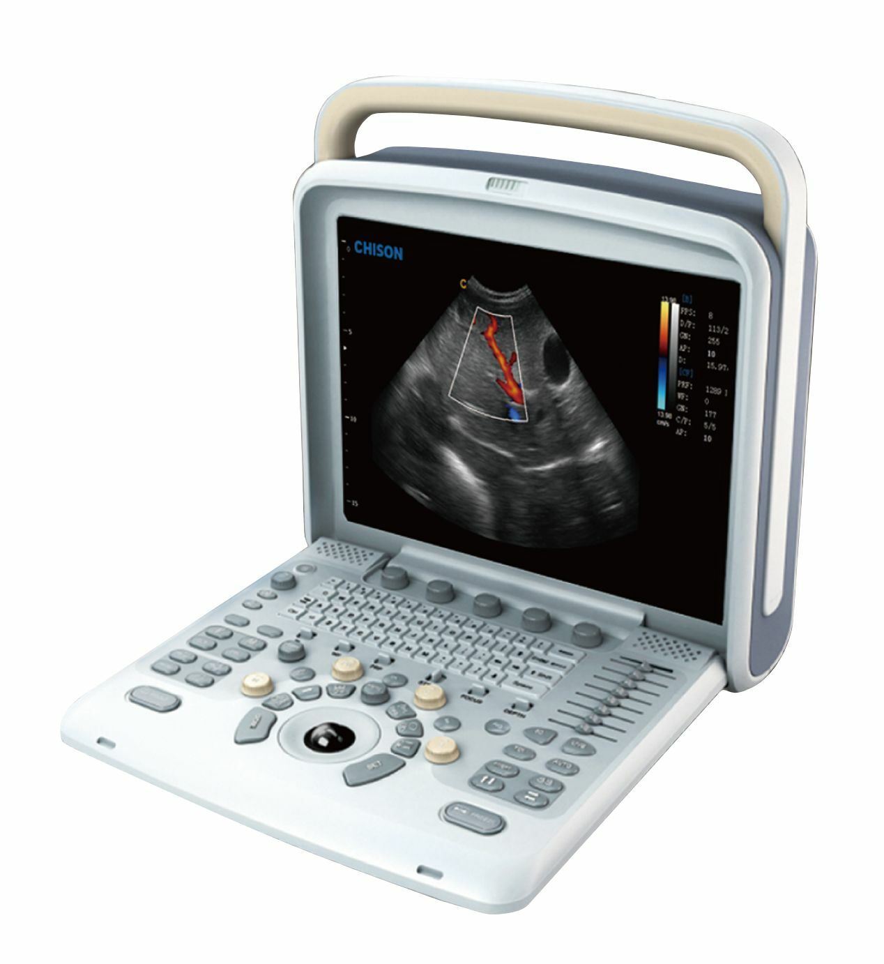 Veterinary Ultrasound Scanner with 2 Probes - Color Doppler Chison Q5Vet DIAGNOSTIC ULTRASOUND MACHINES FOR SALE