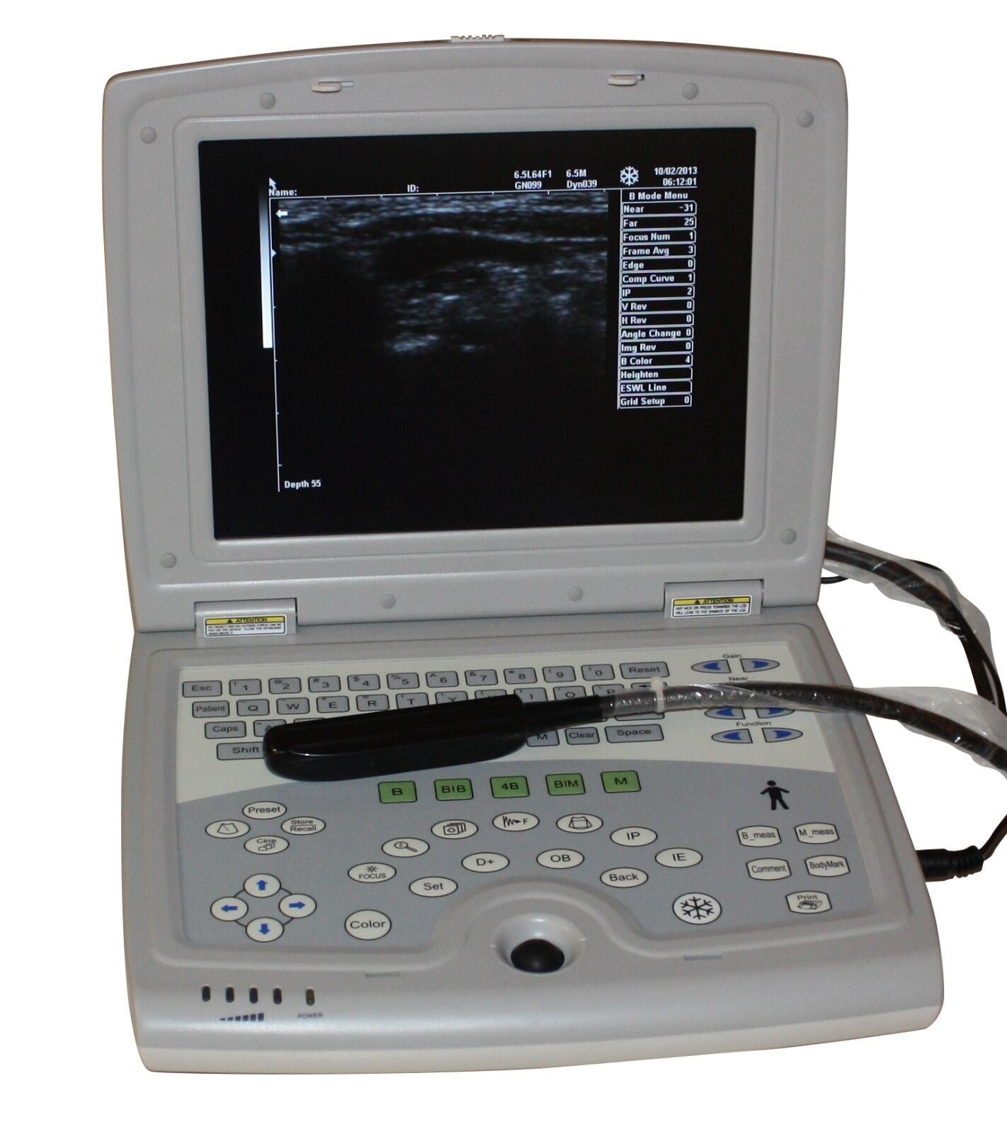 keebomed KX5000KV Veterinary Ultrasound with Rectal Probe DIAGNOSTIC ULTRASOUND MACHINES FOR SALE