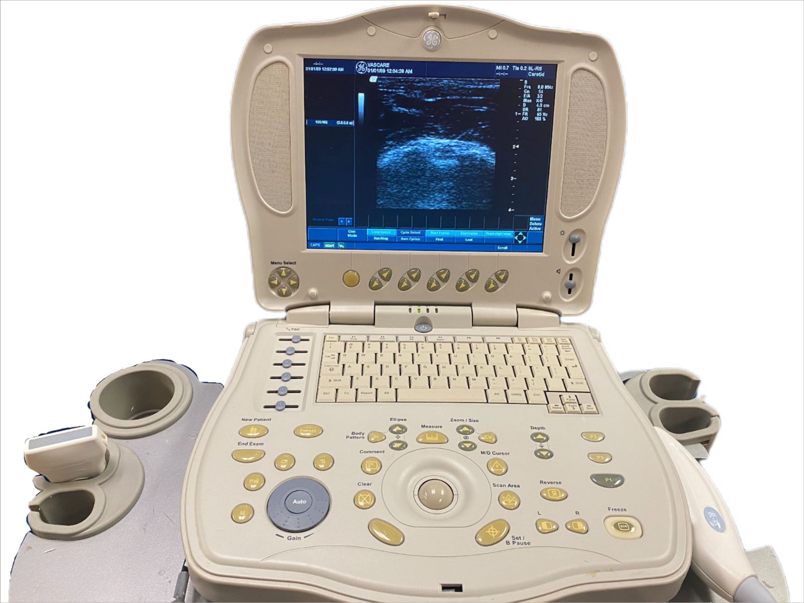 GE LOGIQ BOOK XP PORTABLE ULTRASOUND MACHINE & 8L-RS PROBE 2004 cart/printer DIAGNOSTIC ULTRASOUND MACHINES FOR SALE