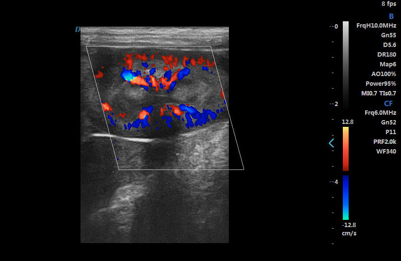 ECO-17Vet High end Equine Ultrasound with Rectal Probe  4-12 MHz Color Doppler DIAGNOSTIC ULTRASOUND MACHINES FOR SALE