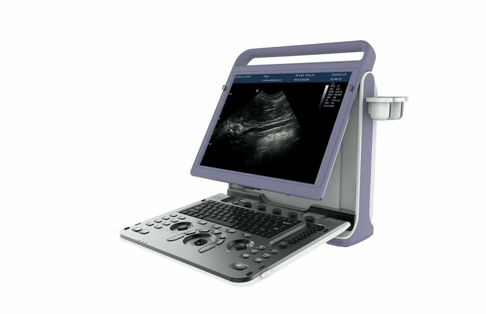 Chison eBit10 Amazing Quality Ultrasound with Linear Array Probe 5.0-15.0Mhz DIAGNOSTIC ULTRASOUND MACHINES FOR SALE