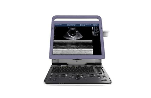 Chison eBit10 Amazing Quality Ultrasound with Linear Array Probe 5.0-15.0Mhz DIAGNOSTIC ULTRASOUND MACHINES FOR SALE