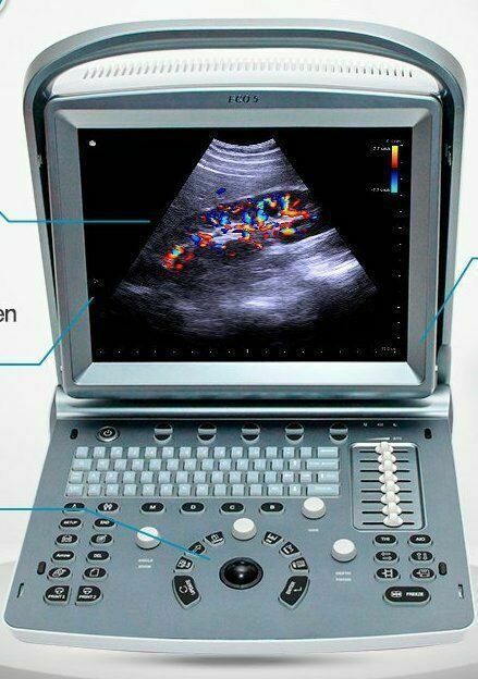 Refurbished Chison ECO5Vet Color Doppler Veterinary Ultrasound, Probe, Warranty DIAGNOSTIC ULTRASOUND MACHINES FOR SALE