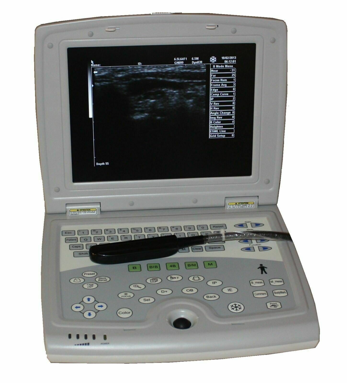 Refurbished KX5000V Vet Laptop Bovine Equine Ultrasound & Rectal Probe & Arm DIAGNOSTIC ULTRASOUND MACHINES FOR SALE