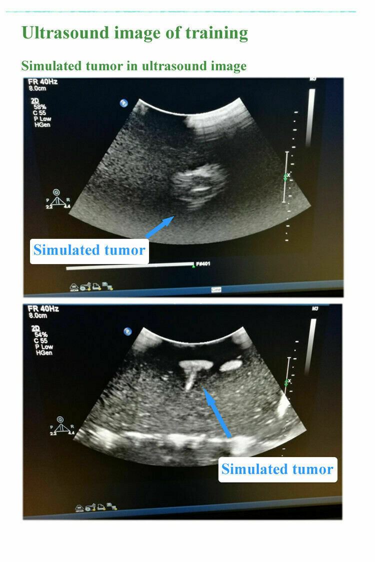 Model for Interventional Ultrasound, Soft tissue, B-Ultrasound Training Teaching DIAGNOSTIC ULTRASOUND MACHINES FOR SALE