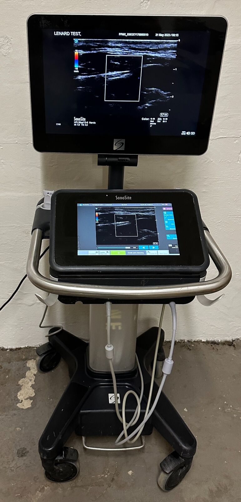 Sonosite X Porte Ultrasound & probes: P21XP, HFL38XP Refurbished, 2020 Spanish DIAGNOSTIC ULTRASOUND MACHINES FOR SALE