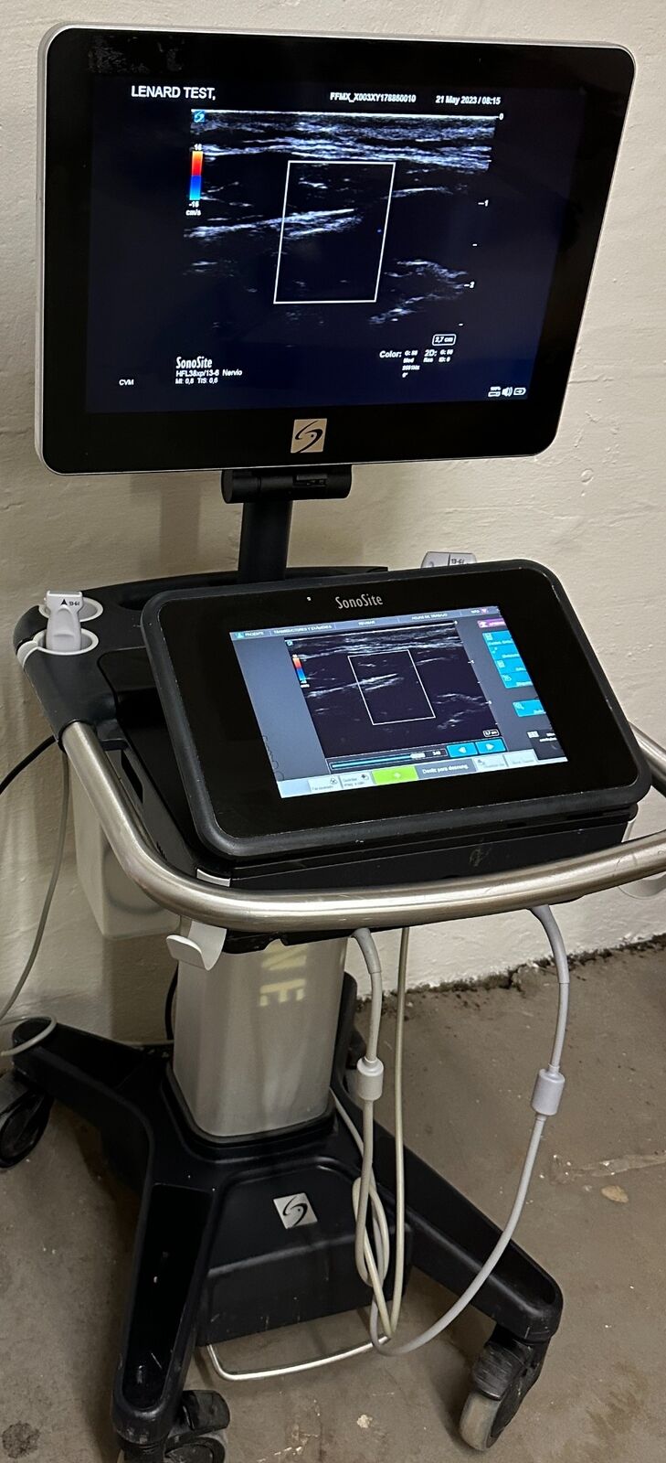 Sonosite X Porte Ultrasound & probes: P21XP, HFL38XP Refurbished, 2020 Spanish DIAGNOSTIC ULTRASOUND MACHINES FOR SALE