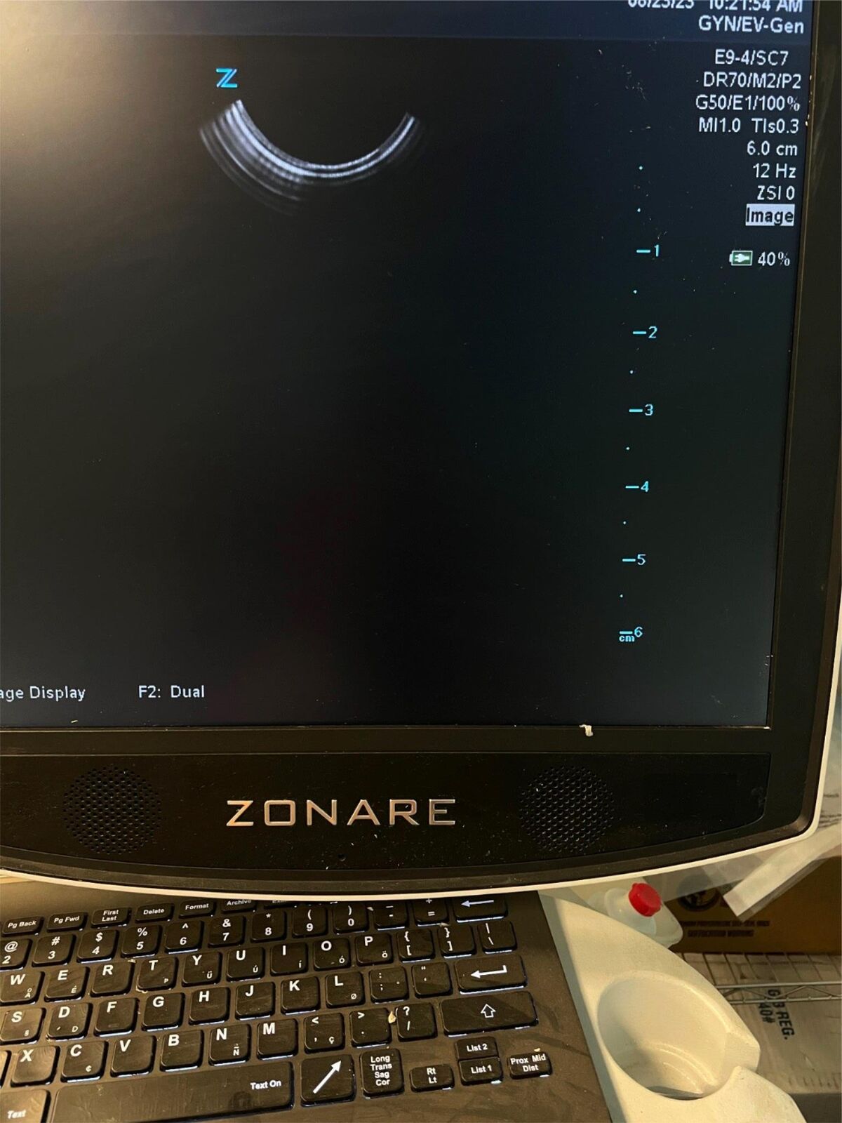 ZONARE E9-4 Ultrasound Probe Transducer DIAGNOSTIC ULTRASOUND MACHINES FOR SALE