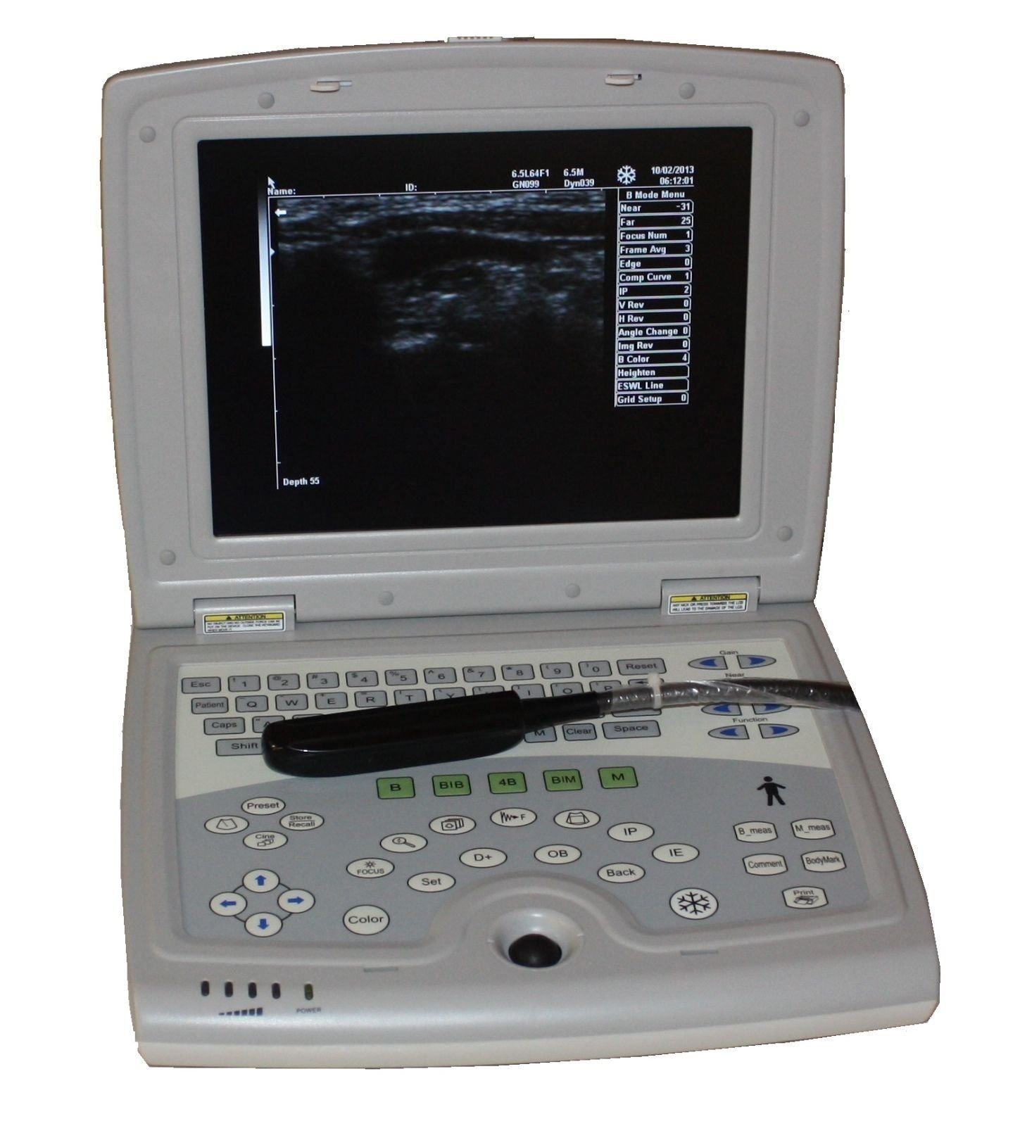 KX5000V Veterinary Laptop Ultrasound-Large Animal-Bovine/Horse- Keebomed DIAGNOSTIC ULTRASOUND MACHINES FOR SALE