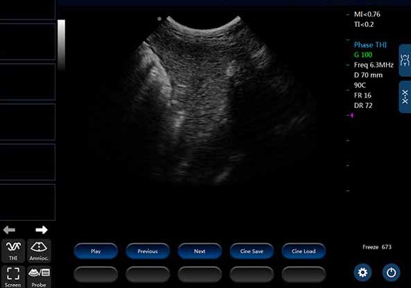 ECO-14Vet High end Equine Ultrasound with Rectal Probe DIAGNOSTIC ULTRASOUND MACHINES FOR SALE