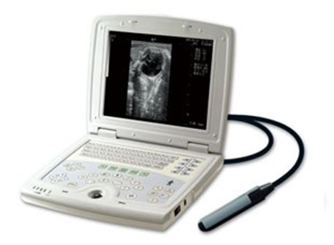 KX5000V Veterinary Laptop Ultrasound-Large Animal-Bovine/Horse- Keebomed DIAGNOSTIC ULTRASOUND MACHINES FOR SALE