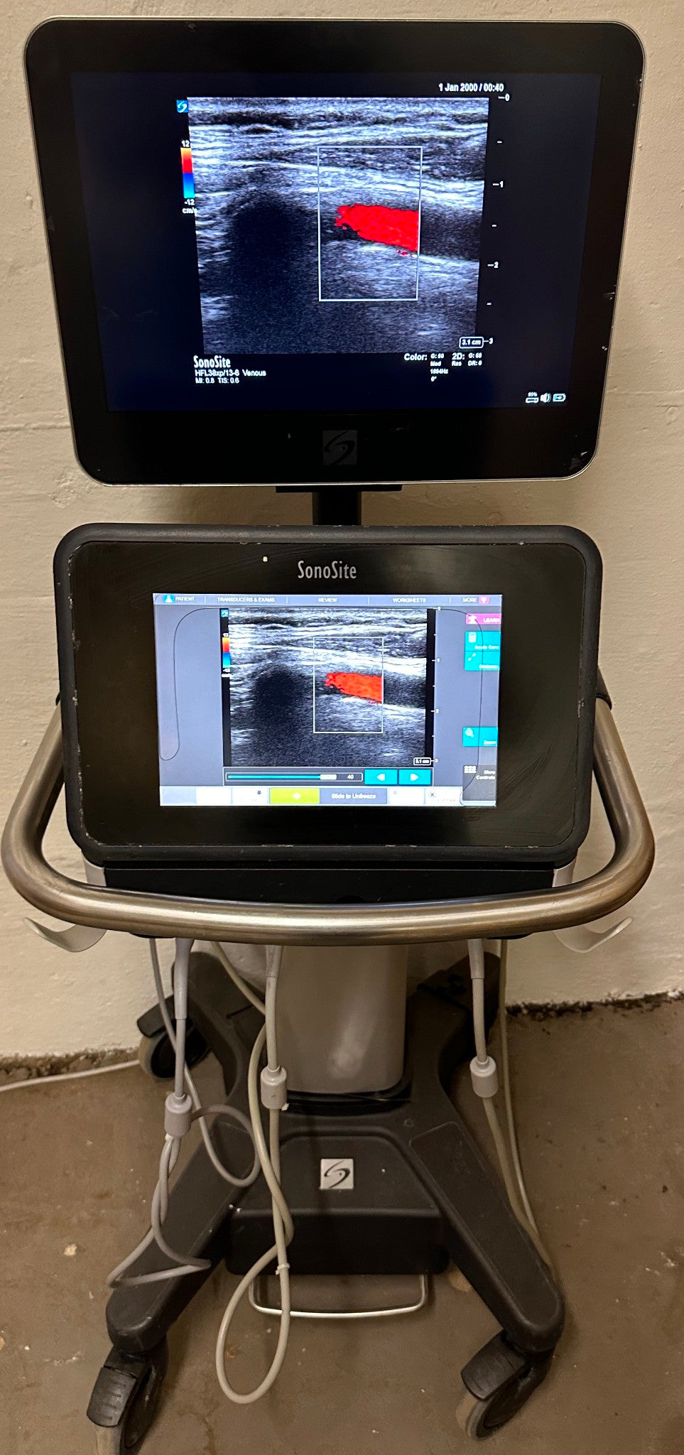 Sonosite X-Porte Ultrasound without probes manufactured 2021 DIAGNOSTIC ULTRASOUND MACHINES FOR SALE