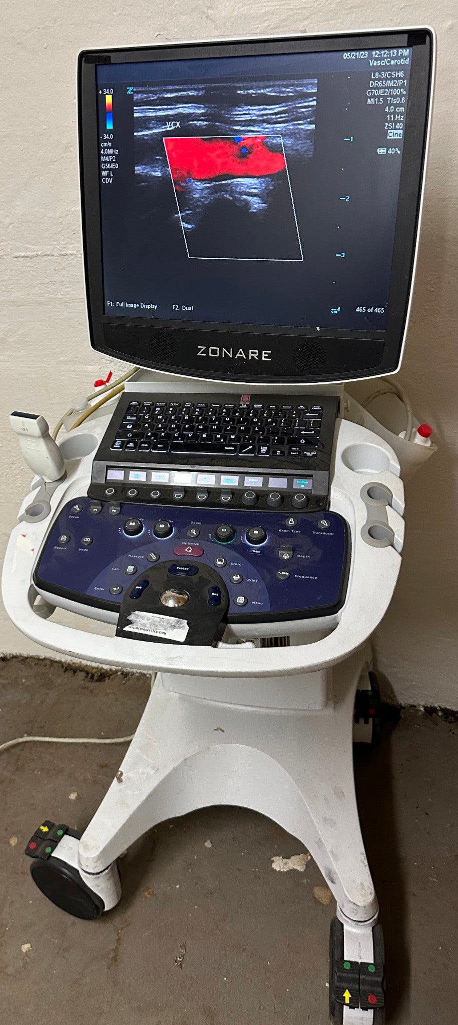 ZONARE ZS 3 Ultrasound Scanner Machine  2015 DIAGNOSTIC ULTRASOUND MACHINES FOR SALE