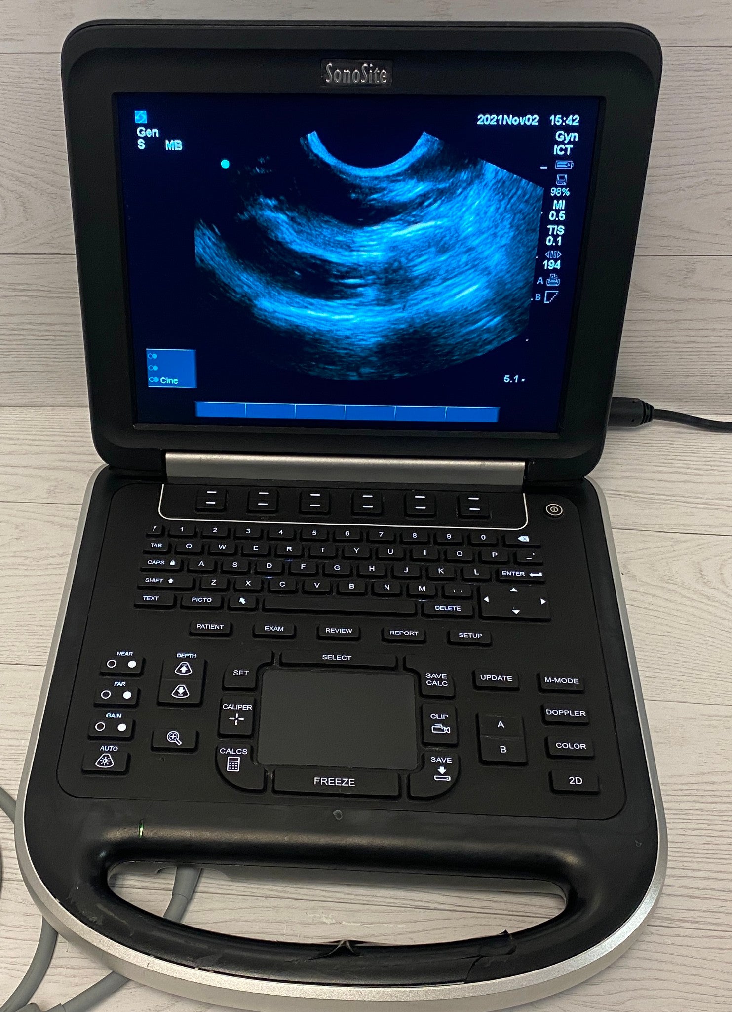 Sonosite Edge Portable ultrasound Manufactured 2012 DIAGNOSTIC ULTRASOUND MACHINES FOR SALE