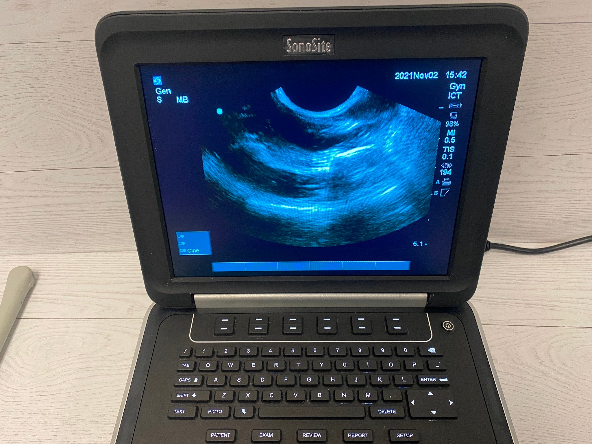 Sonosite Edge Portable ultrasound Manufactured 2012 DIAGNOSTIC ULTRASOUND MACHINES FOR SALE