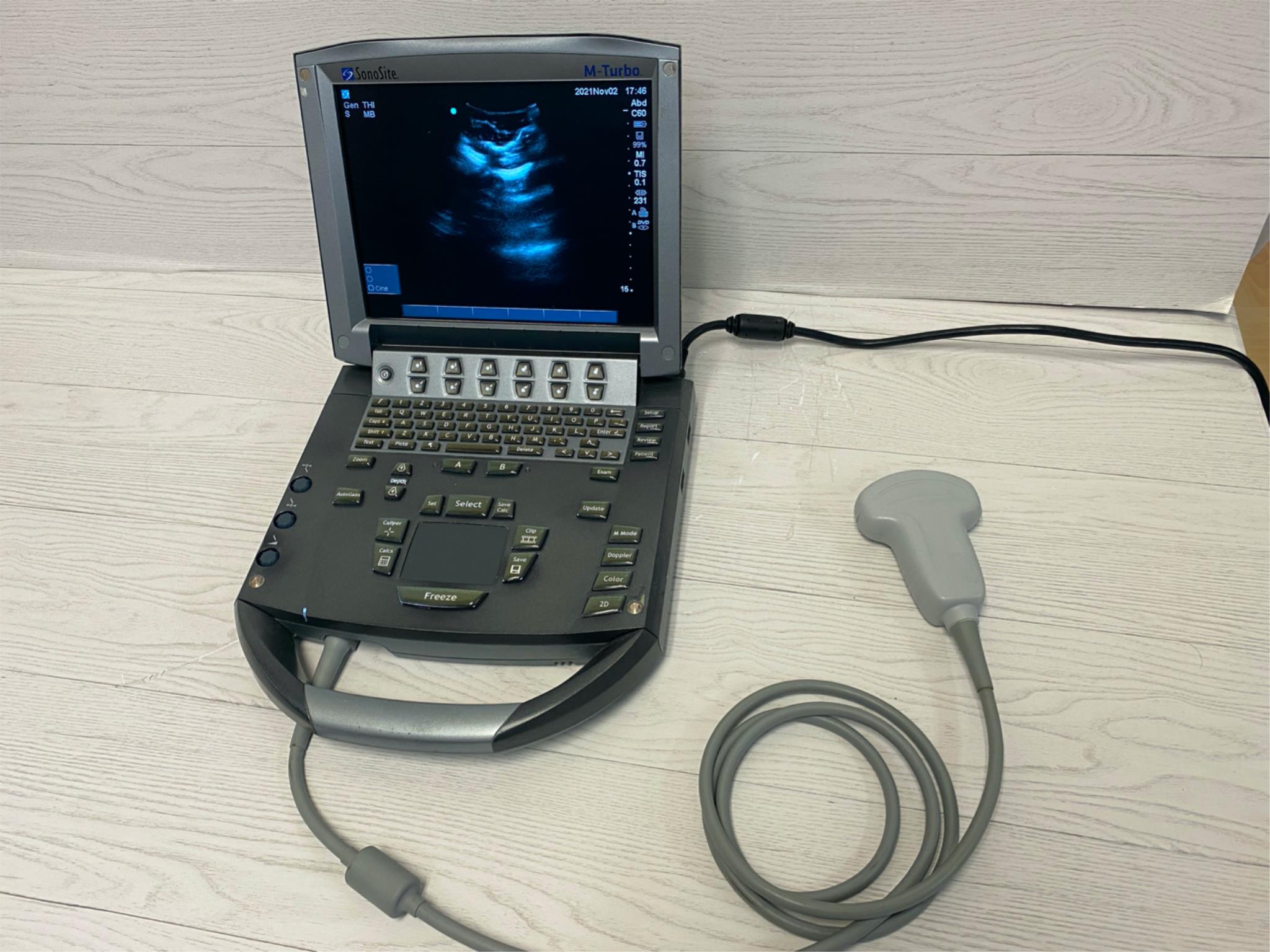 Sonosite Turbo Portable Ultrasound 2010 DIAGNOSTIC ULTRASOUND MACHINES FOR SALE