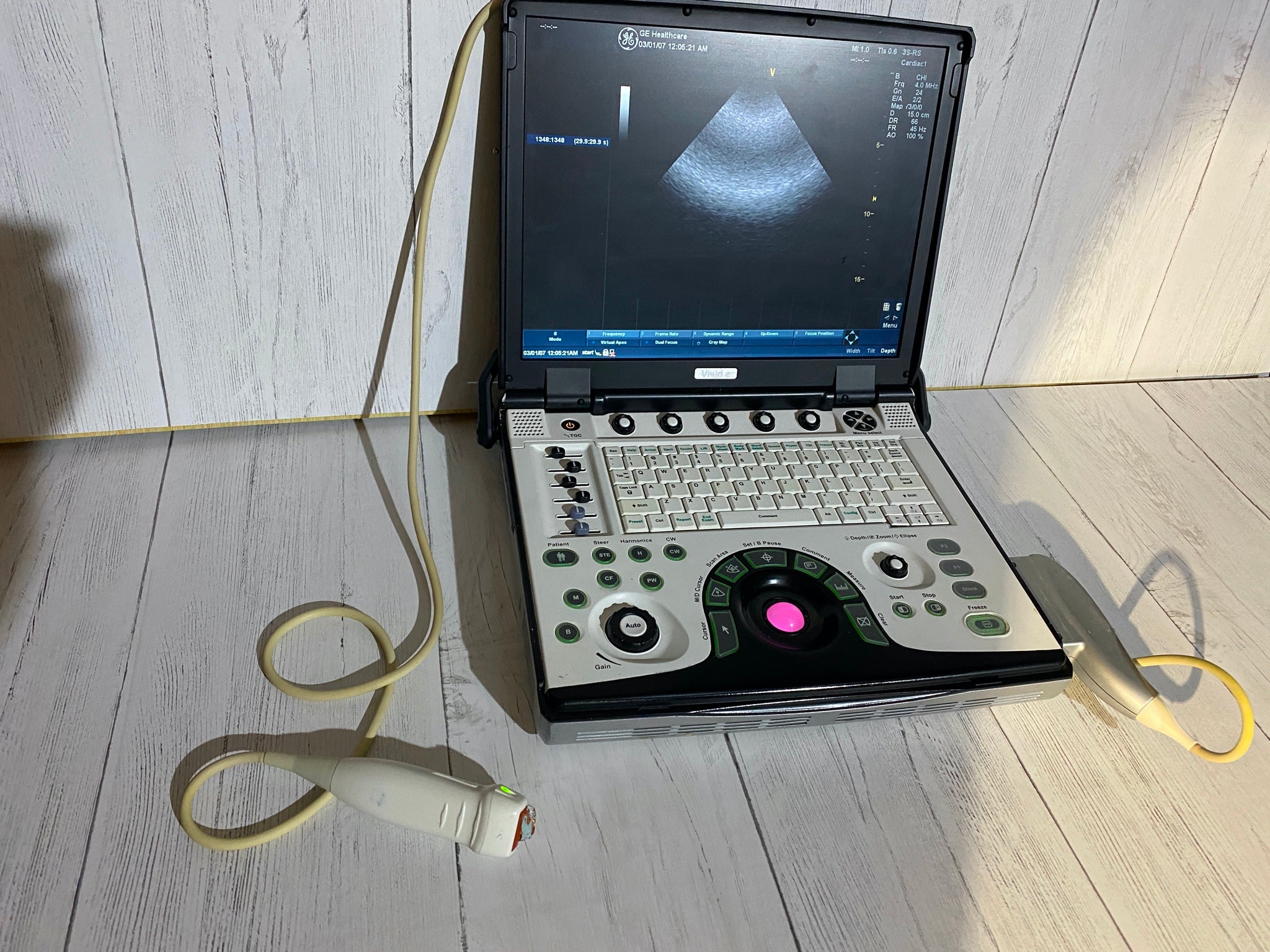 GE VIVID E Portable laptop Ultrasound with phased array probe and CW 2009 DIAGNOSTIC ULTRASOUND MACHINES FOR SALE