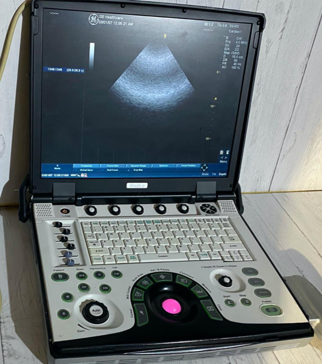 GE Vivid E portable Ultrasound 2009 DIAGNOSTIC ULTRASOUND MACHINES FOR SALE