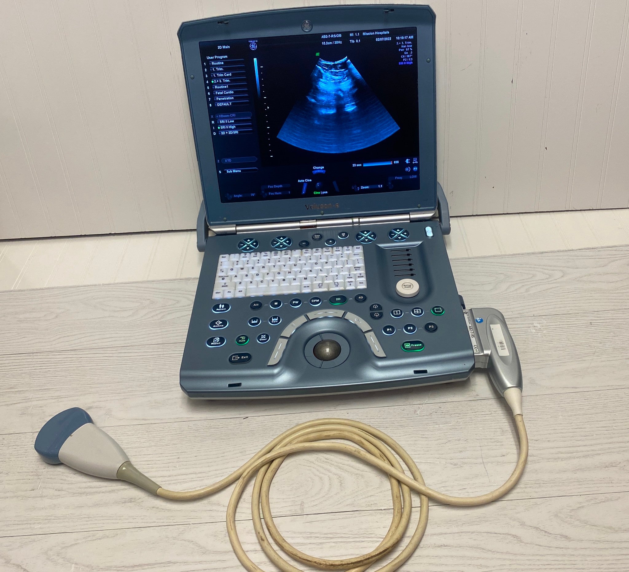 GE VOLUSON E PORTABLE ULTRASOUND MACHINE WITH 1 PROBE (AB2-7-RS) DIAGNOSTIC ULTRASOUND MACHINES FOR SALE