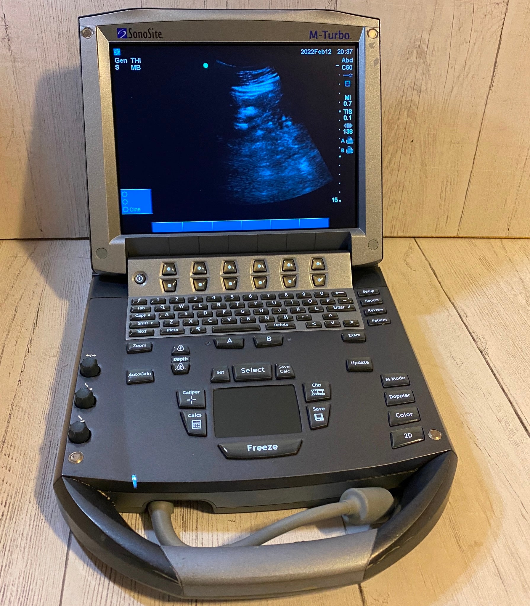 Sonosite M-Turbo Portable Ultrasound 2012 DIAGNOSTIC ULTRASOUND MACHINES FOR SALE