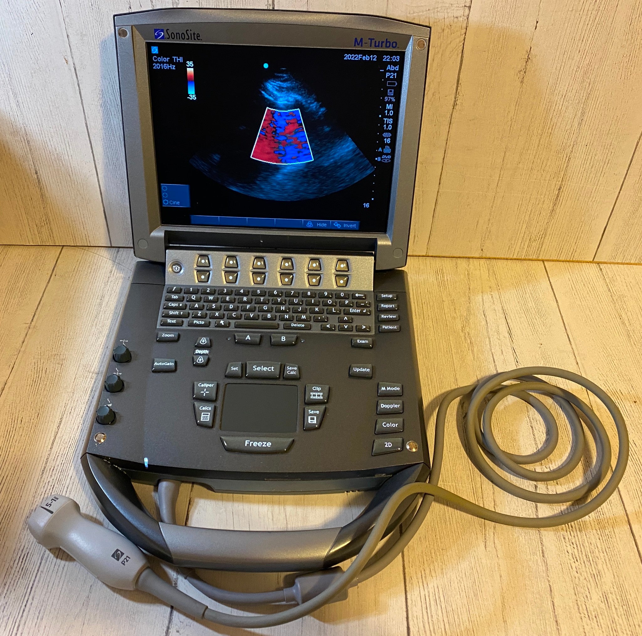 Sonosite M-Turbo Portable Ultrasound 2010 with Phased Array Probe P21 DIAGNOSTIC ULTRASOUND MACHINES FOR SALE