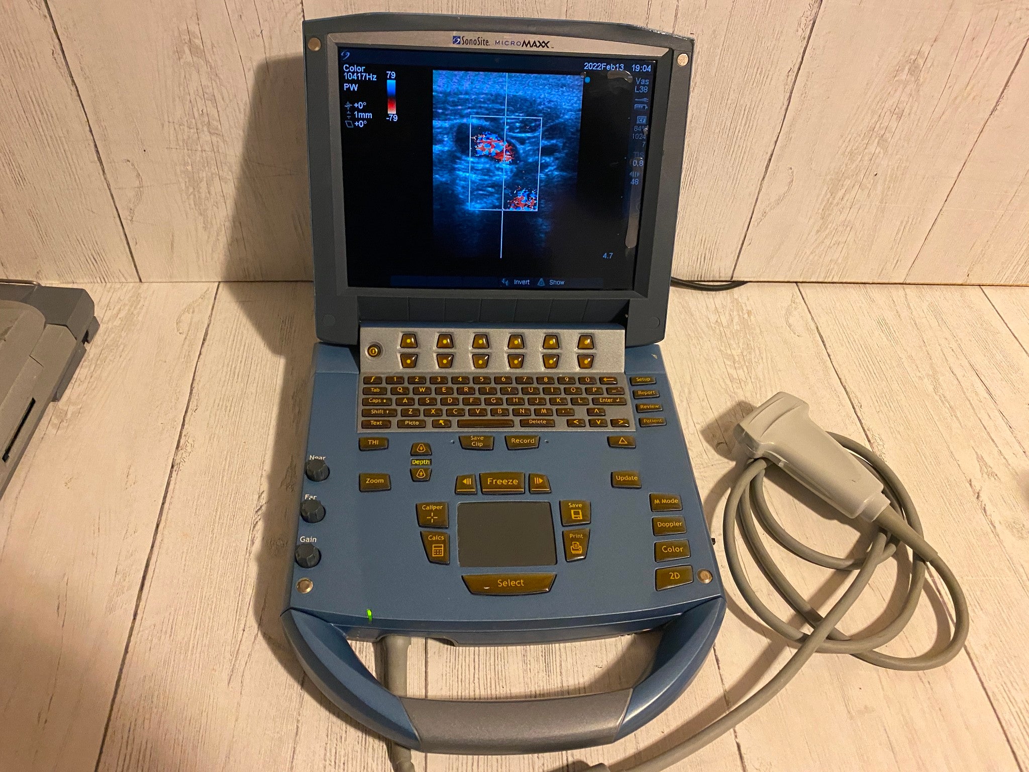 Sonosite MicroMaxx Portable Ultrasound 2005- Main unit For parts DIAGNOSTIC ULTRASOUND MACHINES FOR SALE