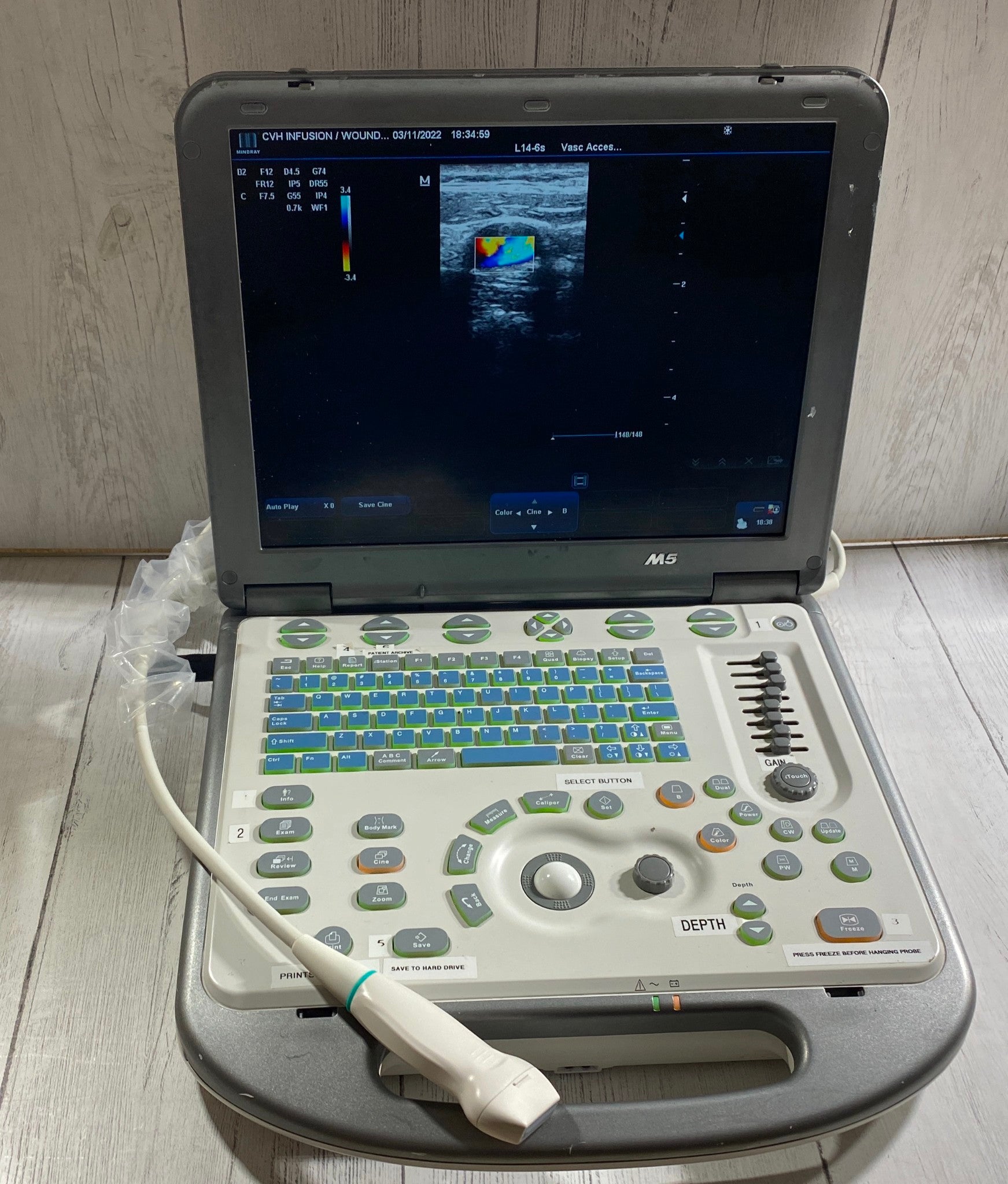 Mindray M5 Portable Ultraspund with one linear array probe DIAGNOSTIC ULTRASOUND MACHINES FOR SALE