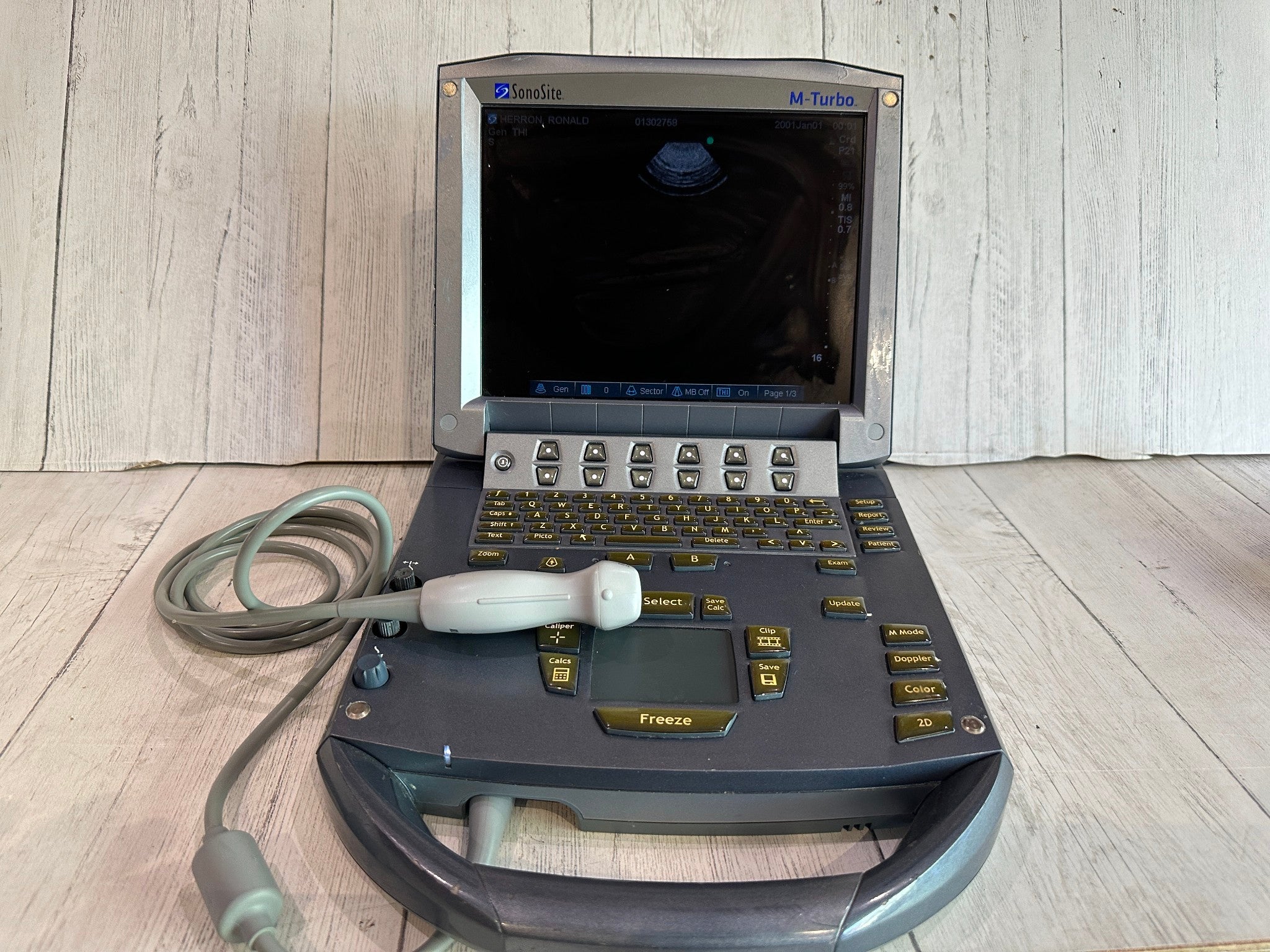 SonoSite M Turbo Ultrasound Machine 2011 With P21x Probe Warranty 6 Months DIAGNOSTIC ULTRASOUND MACHINES FOR SALE