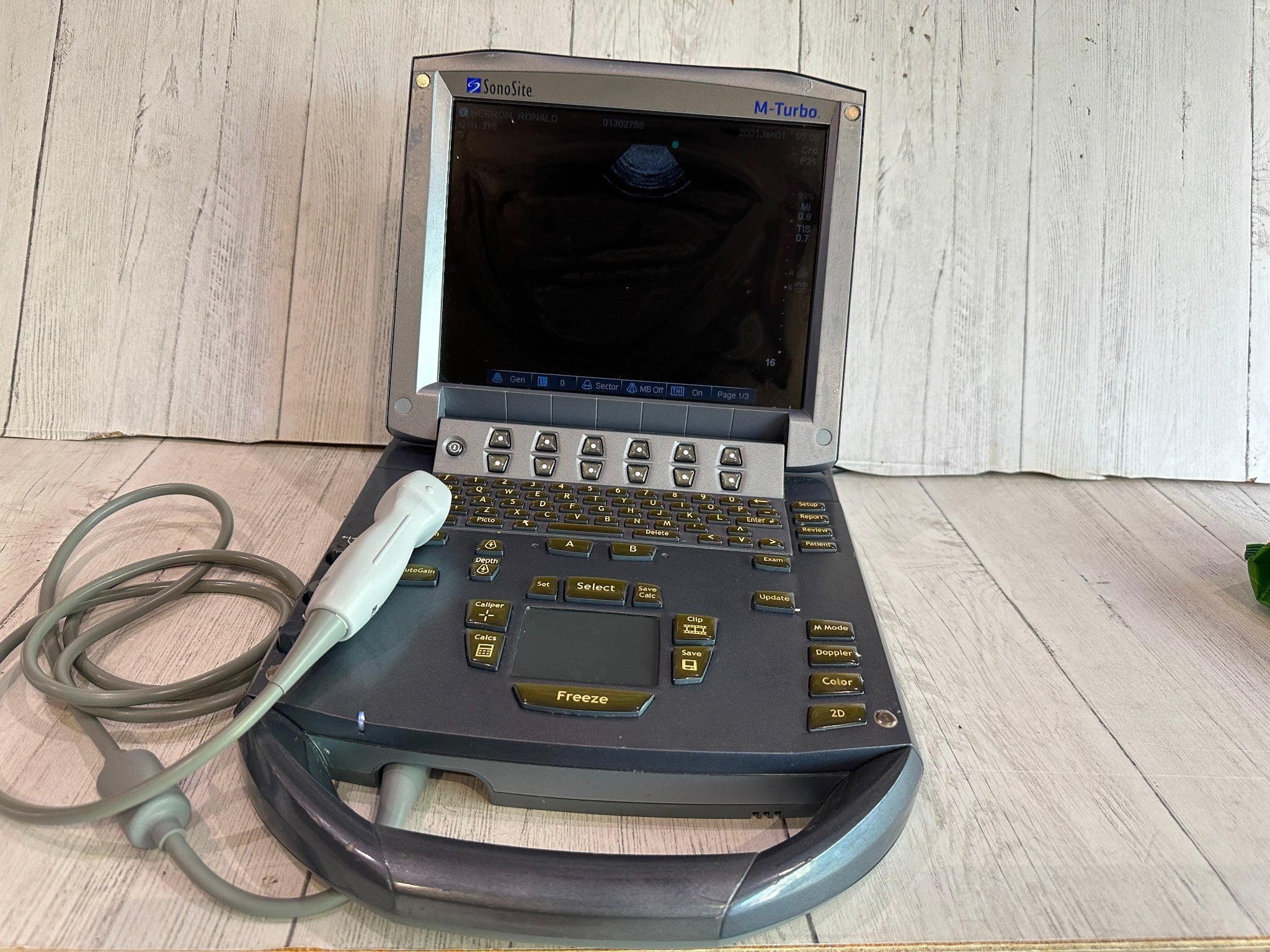 SonoSite M Turbo Ultrasound Machine 2011 With P21x Probe Warranty 6 Months DIAGNOSTIC ULTRASOUND MACHINES FOR SALE