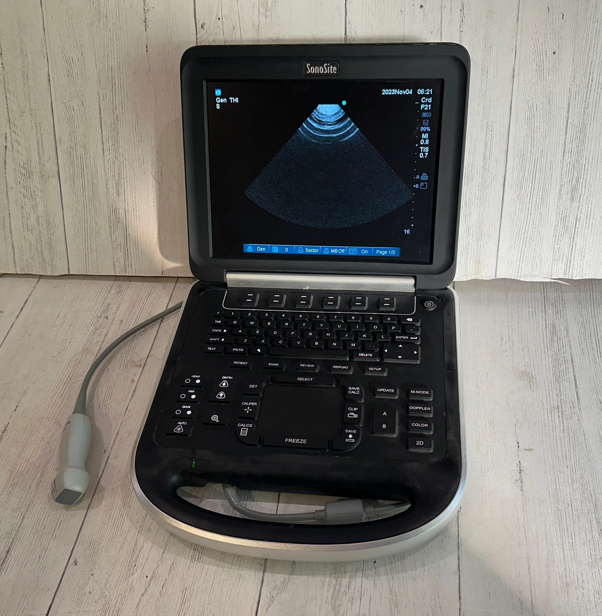 Sonosite Edge Portable Ultrasound & Phased Array Cardiac Probe P21x Warranty DIAGNOSTIC ULTRASOUND MACHINES FOR SALE