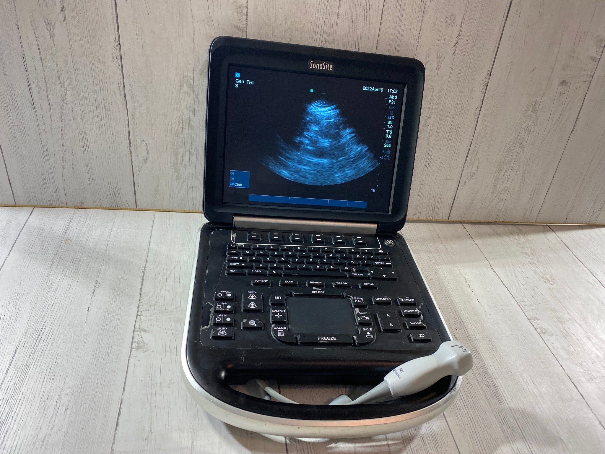 Sonosite Edge Portable ultrasound Manufactured 2013 with P21 Cardiac probe DIAGNOSTIC ULTRASOUND MACHINES FOR SALE