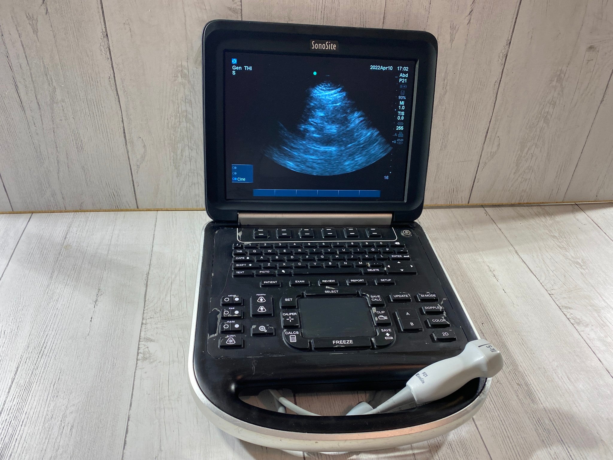 Sonosite Edge Portable ultrasound Manufactured 2013 with P21 Cardiac probe DIAGNOSTIC ULTRASOUND MACHINES FOR SALE