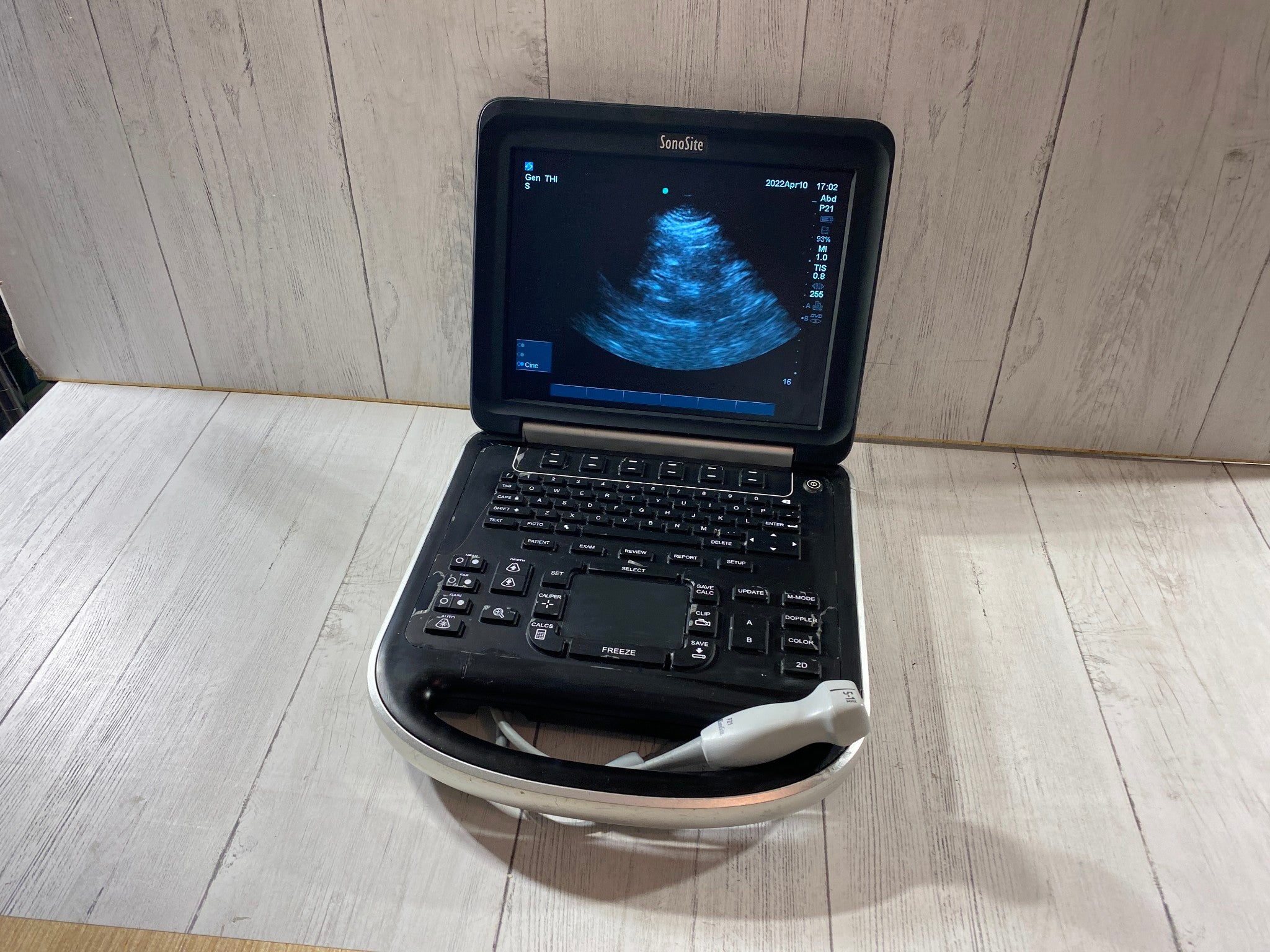 Sonosite Edge Portable ultrasound Manufactured 2013 with P21 Cardiac probe DIAGNOSTIC ULTRASOUND MACHINES FOR SALE