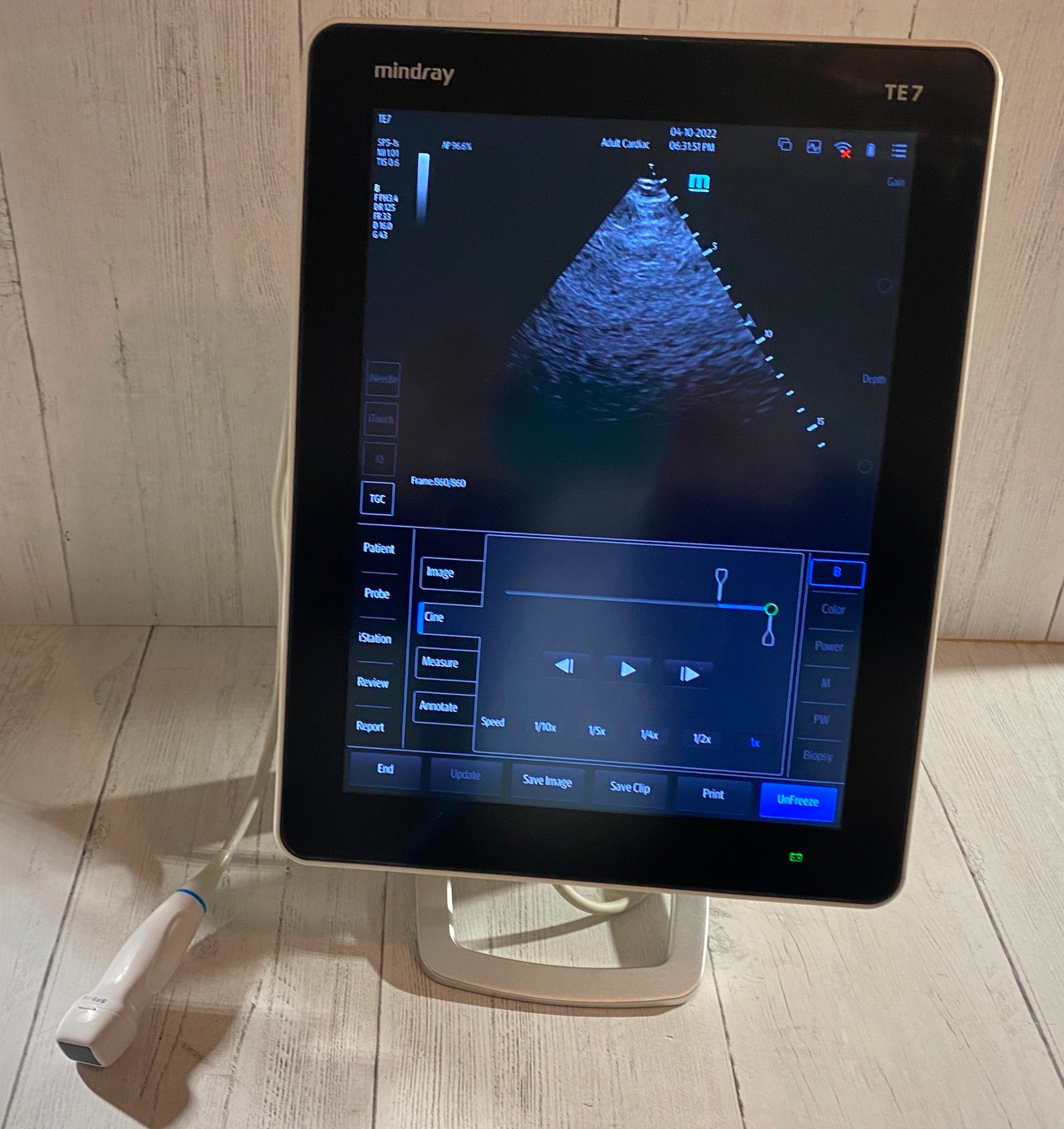 Touch screen Ultrasound Mindray TE 7 with cardiac phased array probe SP5-1s 2019 DIAGNOSTIC ULTRASOUND MACHINES FOR SALE