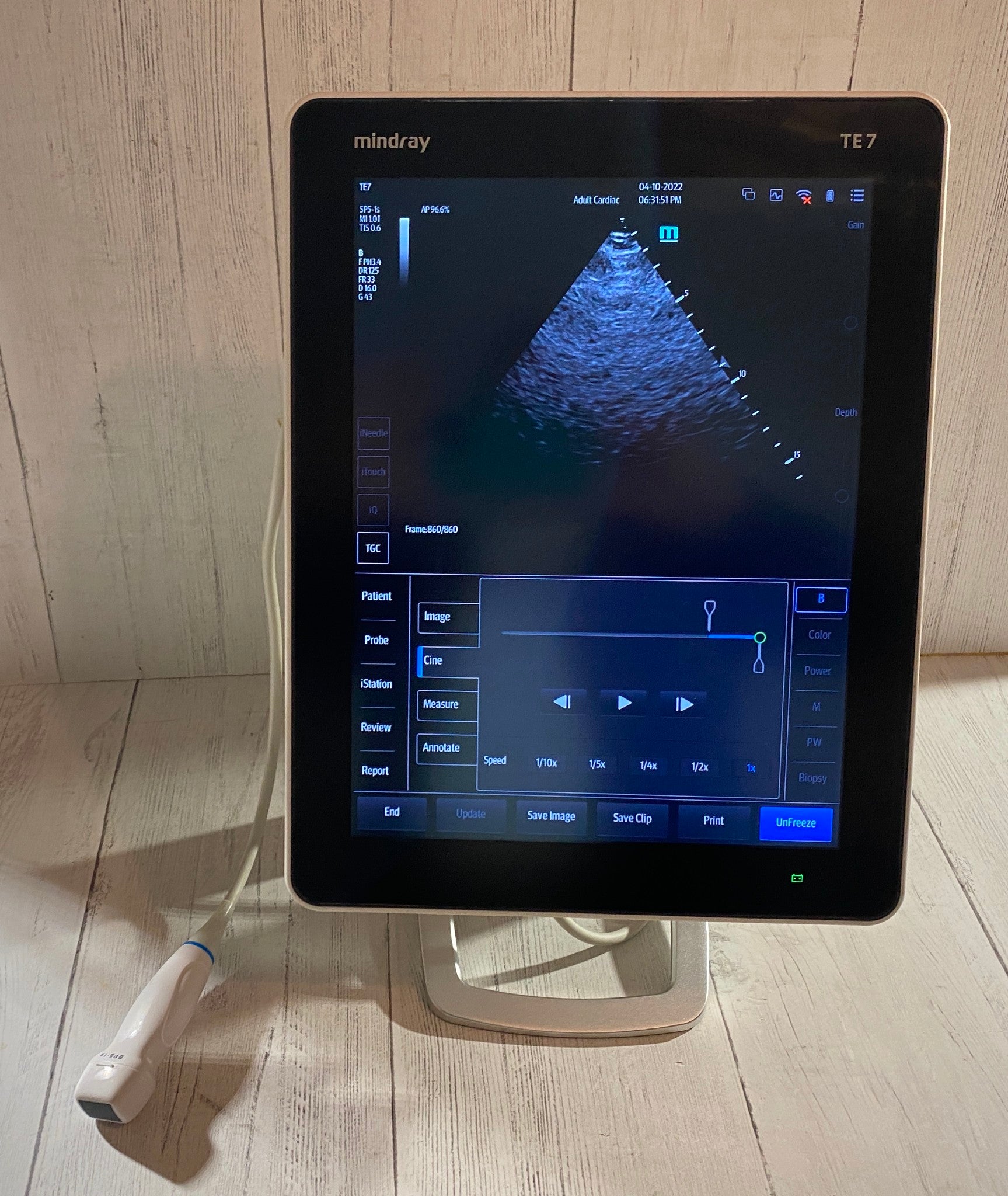 Touch screen Ultrasound Mindray TE 7 with cardiac phased array probe SP5-1s 2019 DIAGNOSTIC ULTRASOUND MACHINES FOR SALE