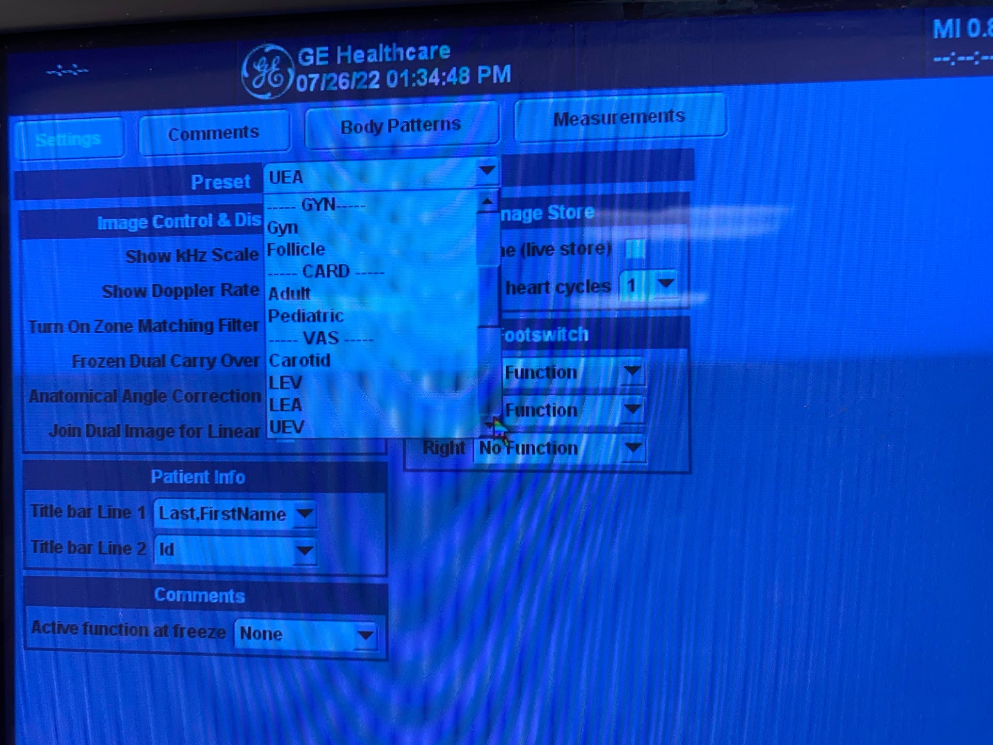 GE LOGIQ 9 ULTRASOUND MACHINE WITH 3 PROBES (M12L, E8C, 9L) 2005 DIAGNOSTIC ULTRASOUND MACHINES FOR SALE