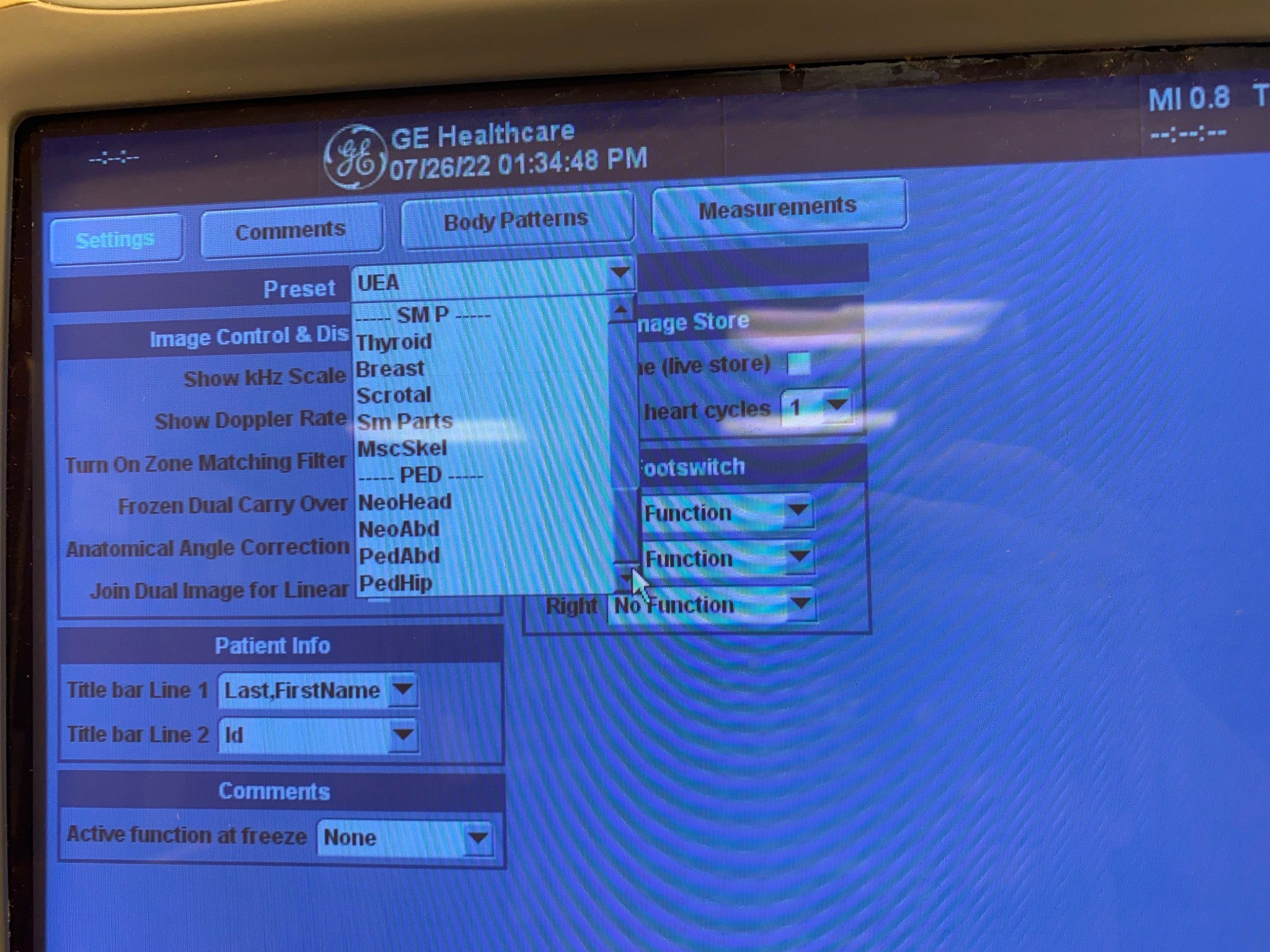 GE LOGIQ 9 ULTRASOUND MACHINE WITH 3 PROBES (M12L, E8C, 9L) 2005 DIAGNOSTIC ULTRASOUND MACHINES FOR SALE