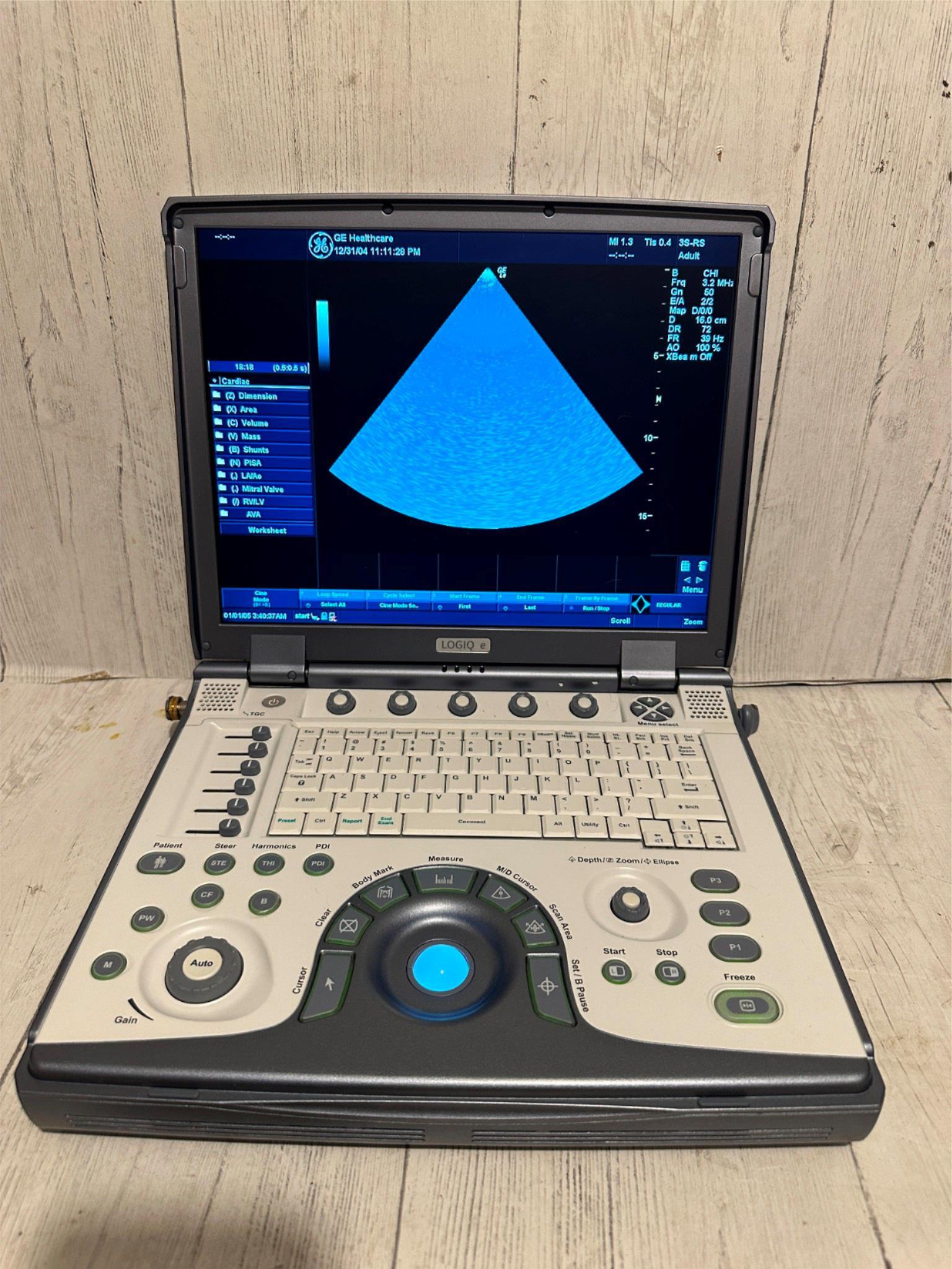 GE LOGIQ E Ultrasound 2006, Vascular, OBGYN, MSK DIAGNOSTIC ULTRASOUND MACHINES FOR SALE