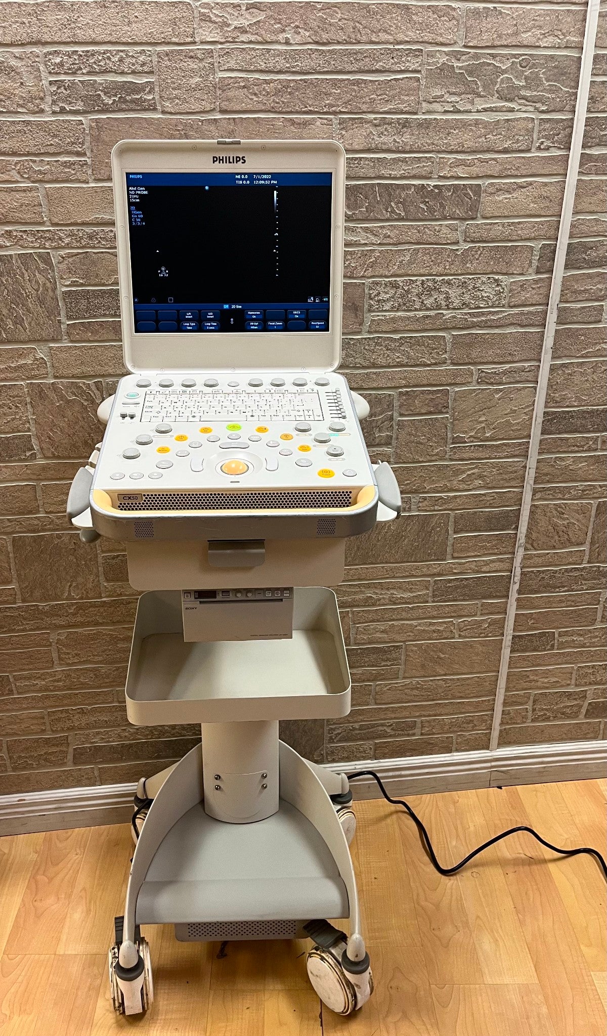 Philips CX50 Ultrasound Scanner Machine 2011 with cart DIAGNOSTIC ULTRASOUND MACHINES FOR SALE