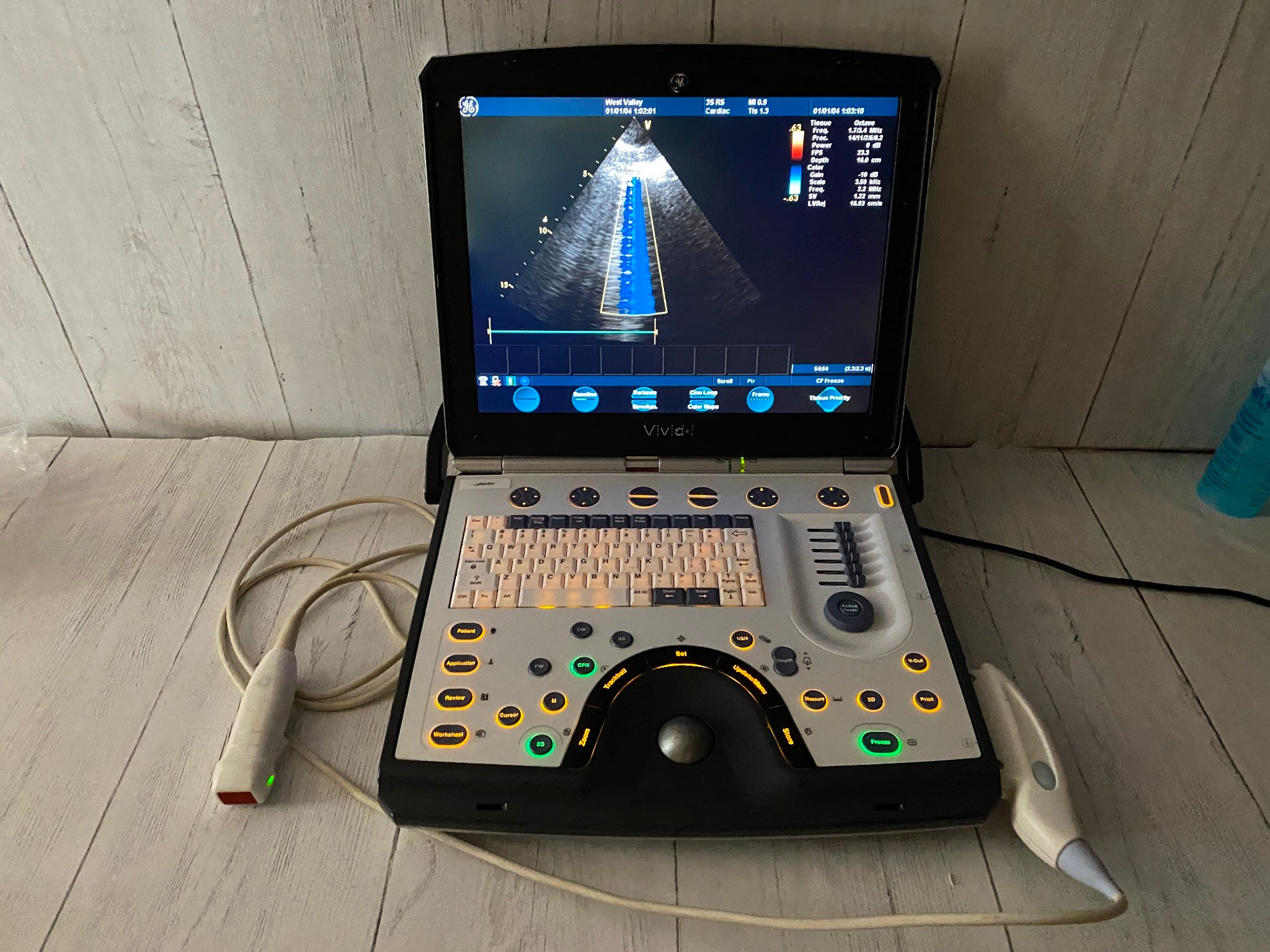 GE Vivid I  Color Doppler Ultrasound Scanner, CW  BT10 with 3s-RS cardiac probe DIAGNOSTIC ULTRASOUND MACHINES FOR SALE