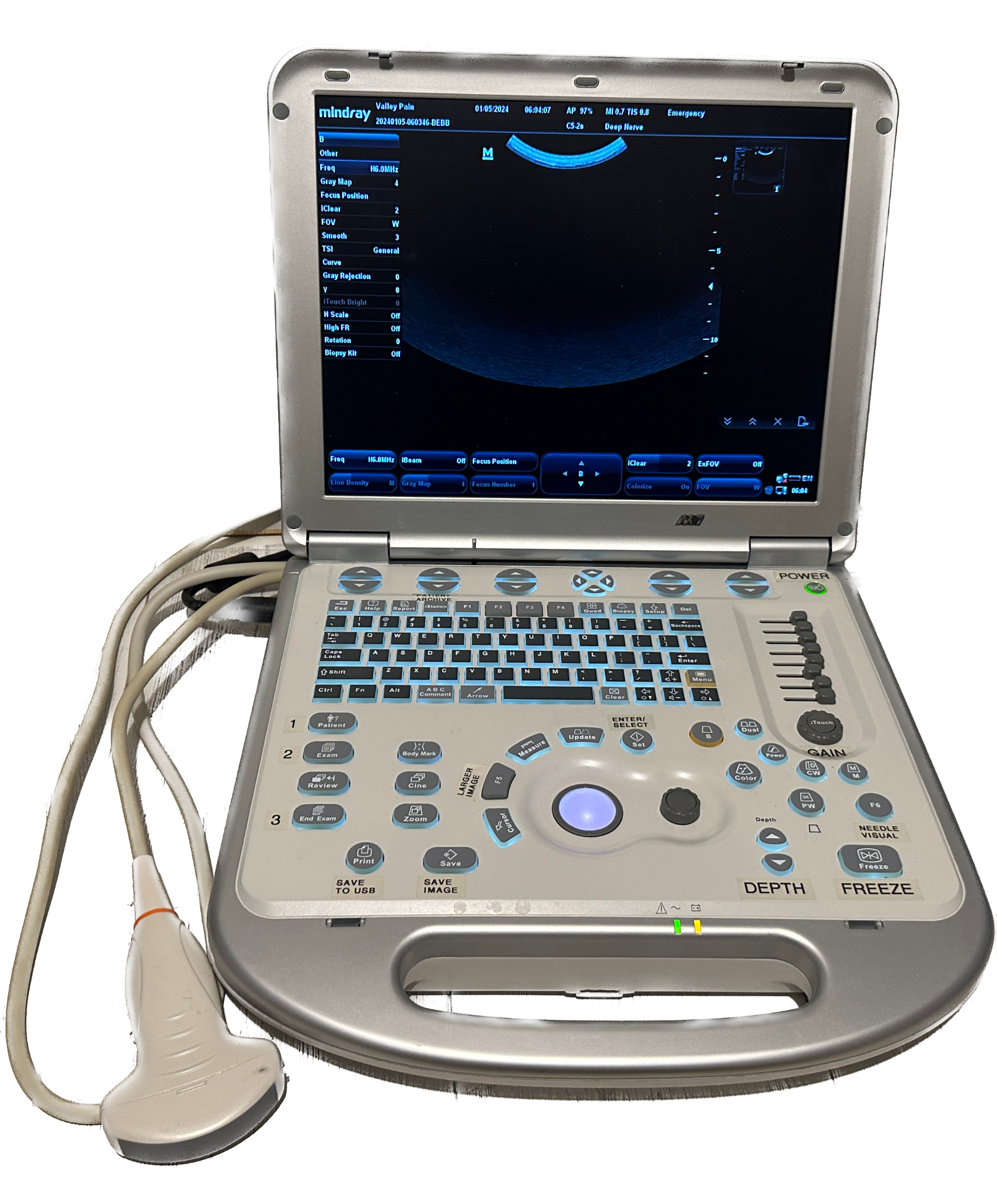 Mindray M7 Ultrasound Machine With 2 Probes (C5-2S, L14-6NS) & Hard Rolling Case DIAGNOSTIC ULTRASOUND MACHINES FOR SALE