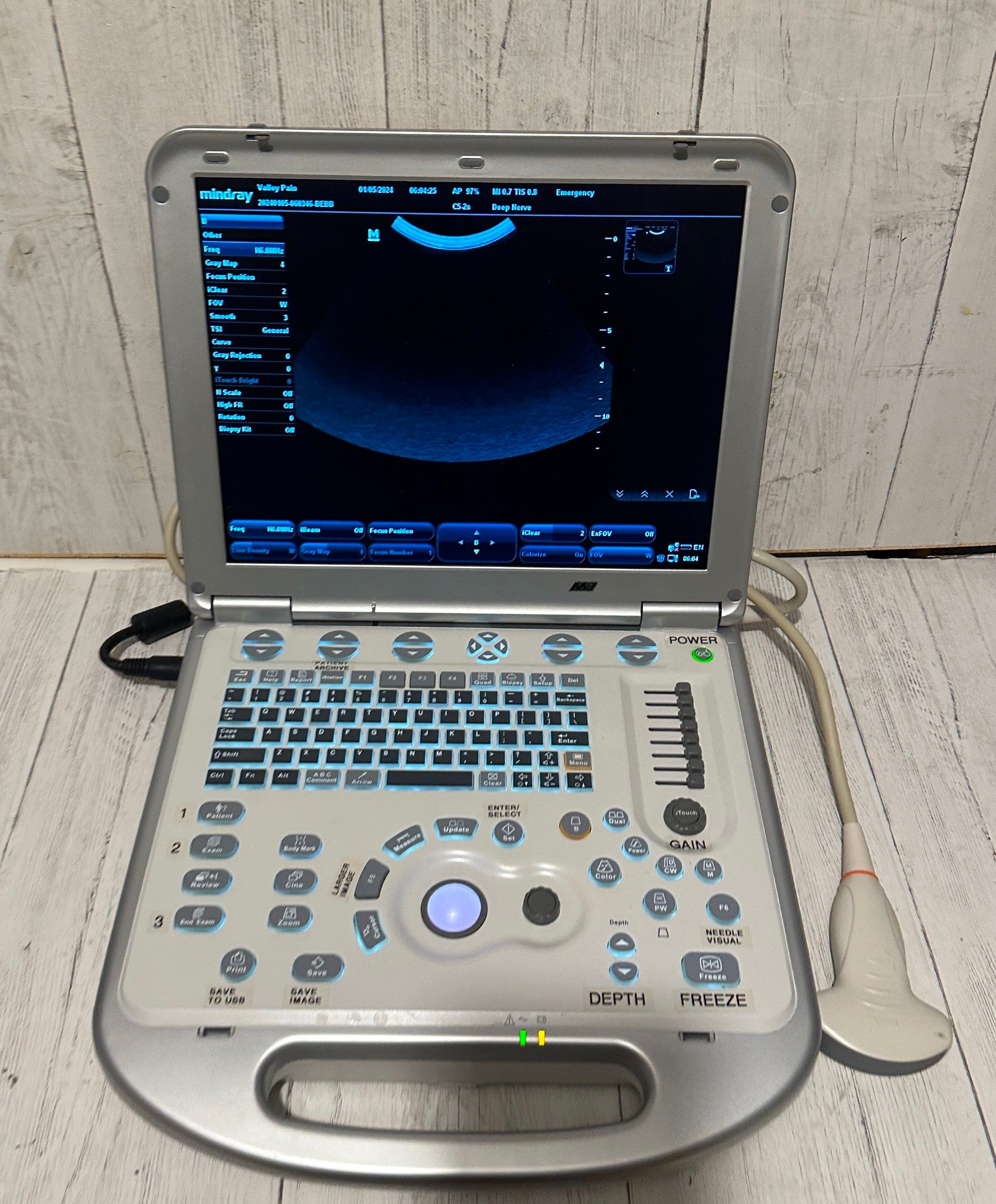 Mindray M7 Ultrasound Machine With 2 Probes (C5-2S, L14-6NS) & Hard Rolling Case DIAGNOSTIC ULTRASOUND MACHINES FOR SALE