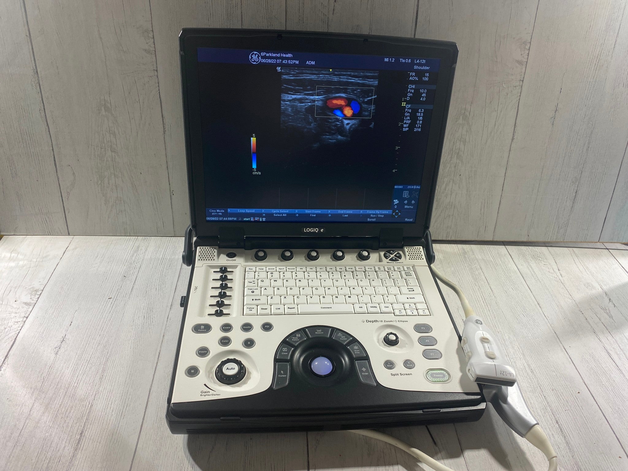 GE LOGIQ E Next Generation Ultrasound machine & Probe -L4-12T DOM 2014 R8.0.4 DIAGNOSTIC ULTRASOUND MACHINES FOR SALE