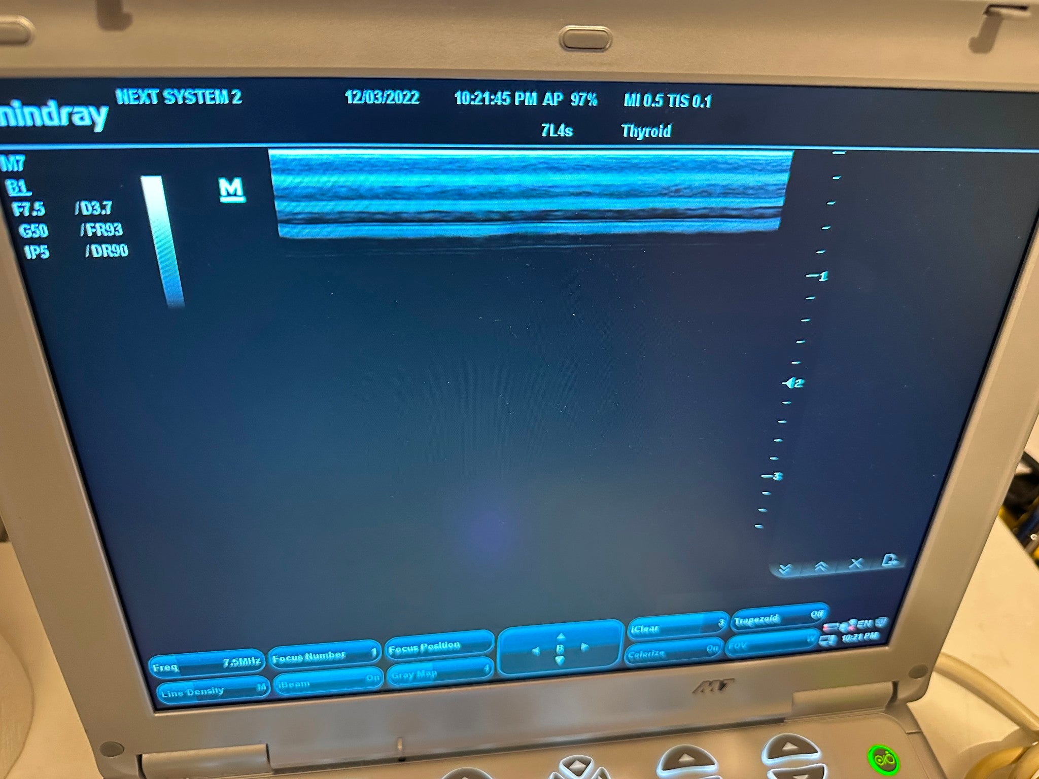 Mindray 7L-4s Linear Array Ultrasound Probe for M7 Very Good, Warranty 1 Year DIAGNOSTIC ULTRASOUND MACHINES FOR SALE