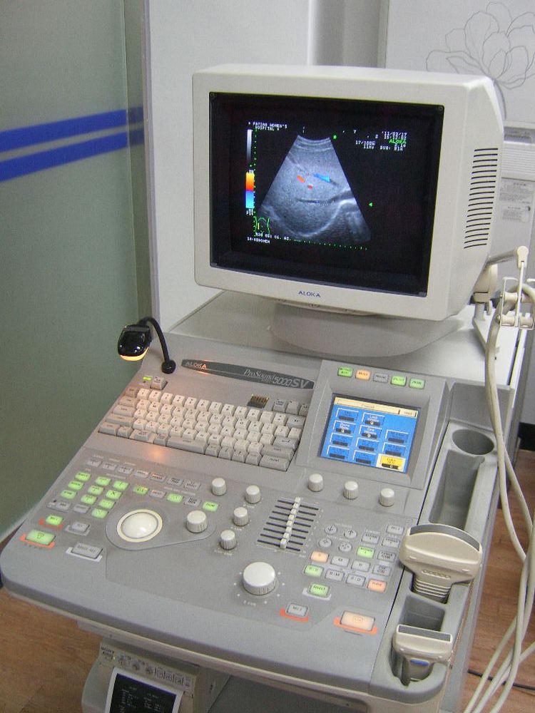 ALOKA SSD-5500 ULTRASOUND MACHINE+ Linear Probe. excellent operational condition DIAGNOSTIC ULTRASOUND MACHINES FOR SALE