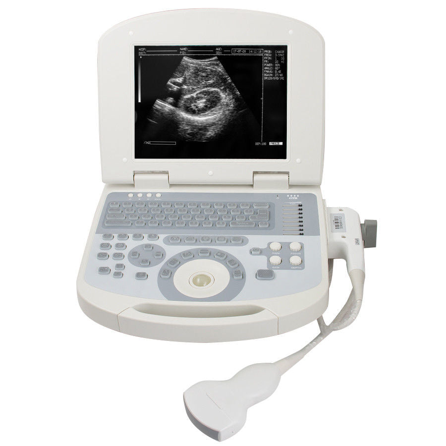 USA Fast 96 Element Clear Digital Laptop Ultrasound Scanner System +Convex probe 190891205612 DIAGNOSTIC ULTRASOUND MACHINES FOR SALE