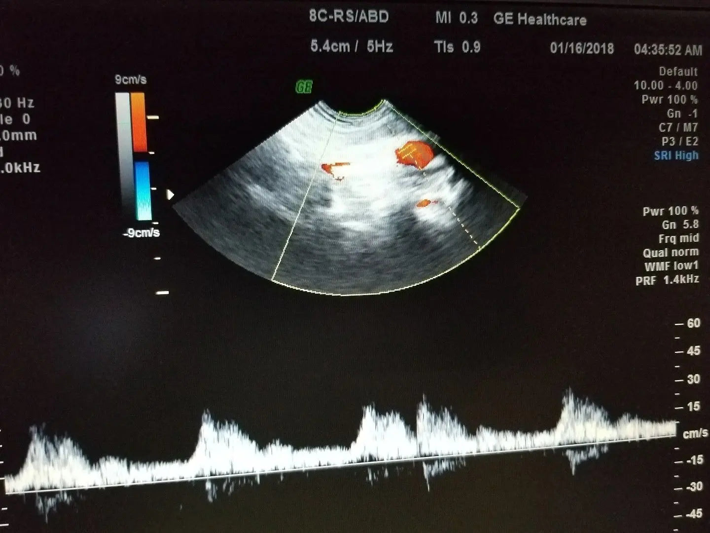 GE 8C-RS Ultrasound Probe / Transducer DIAGNOSTIC ULTRASOUND MACHINES FOR SALE